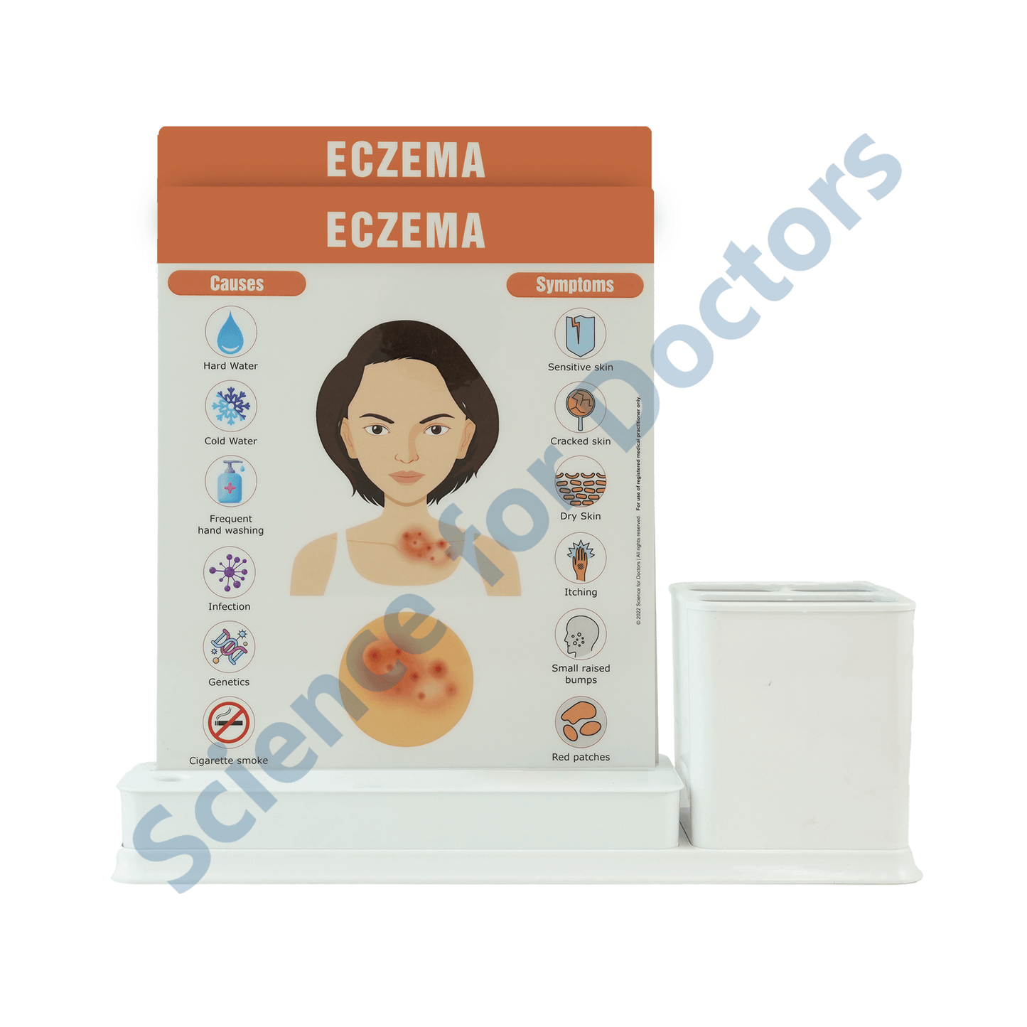 Eczema: 2 slide on stand with Stationary stand