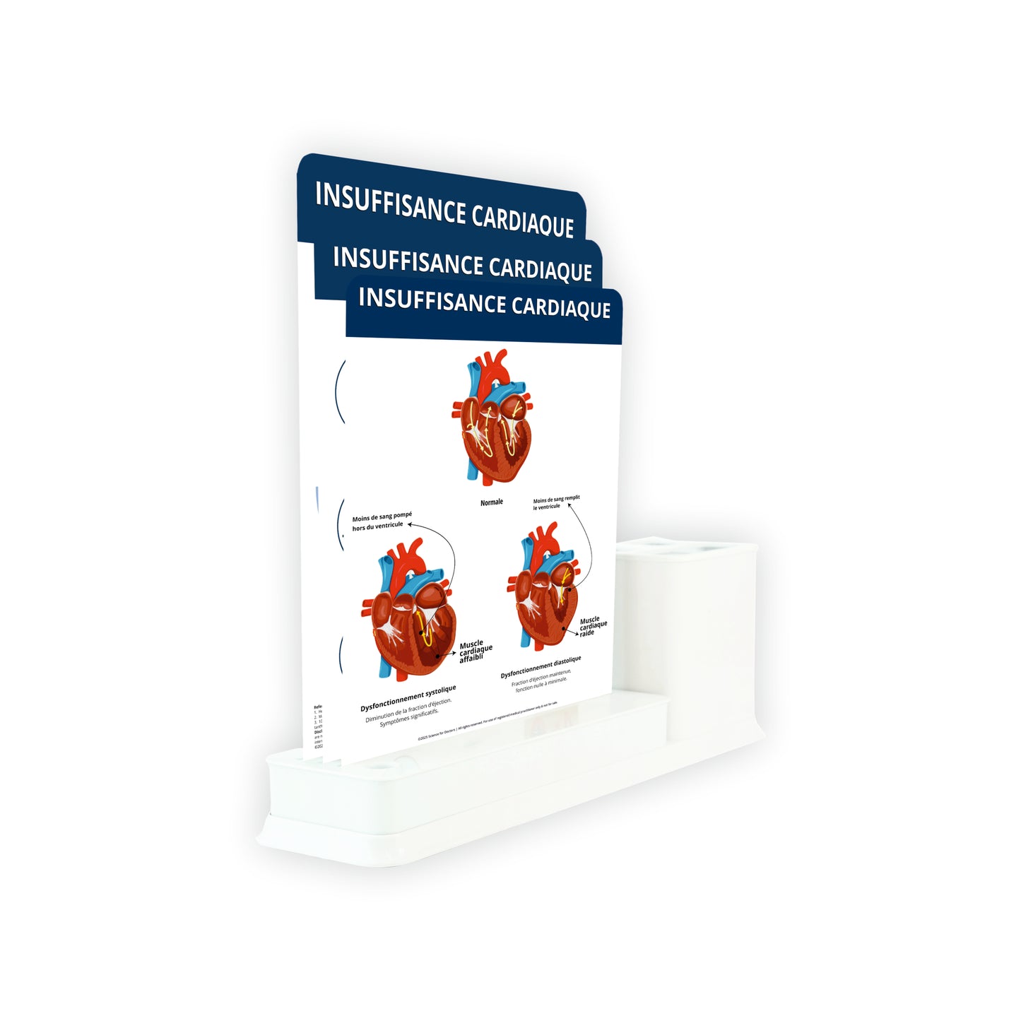 Insuffisance Cardiaque: 3 Slides Write & Wipe with Stationary Stand