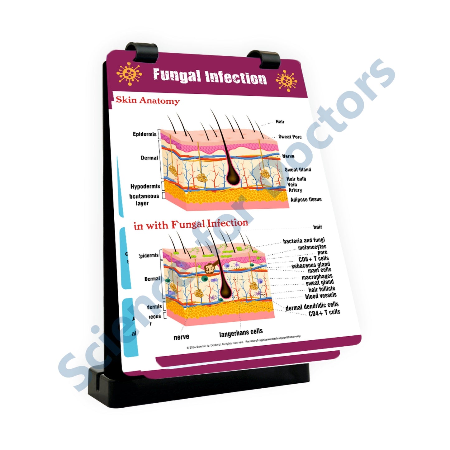 Fungal Infection: A4 Flip Wipe