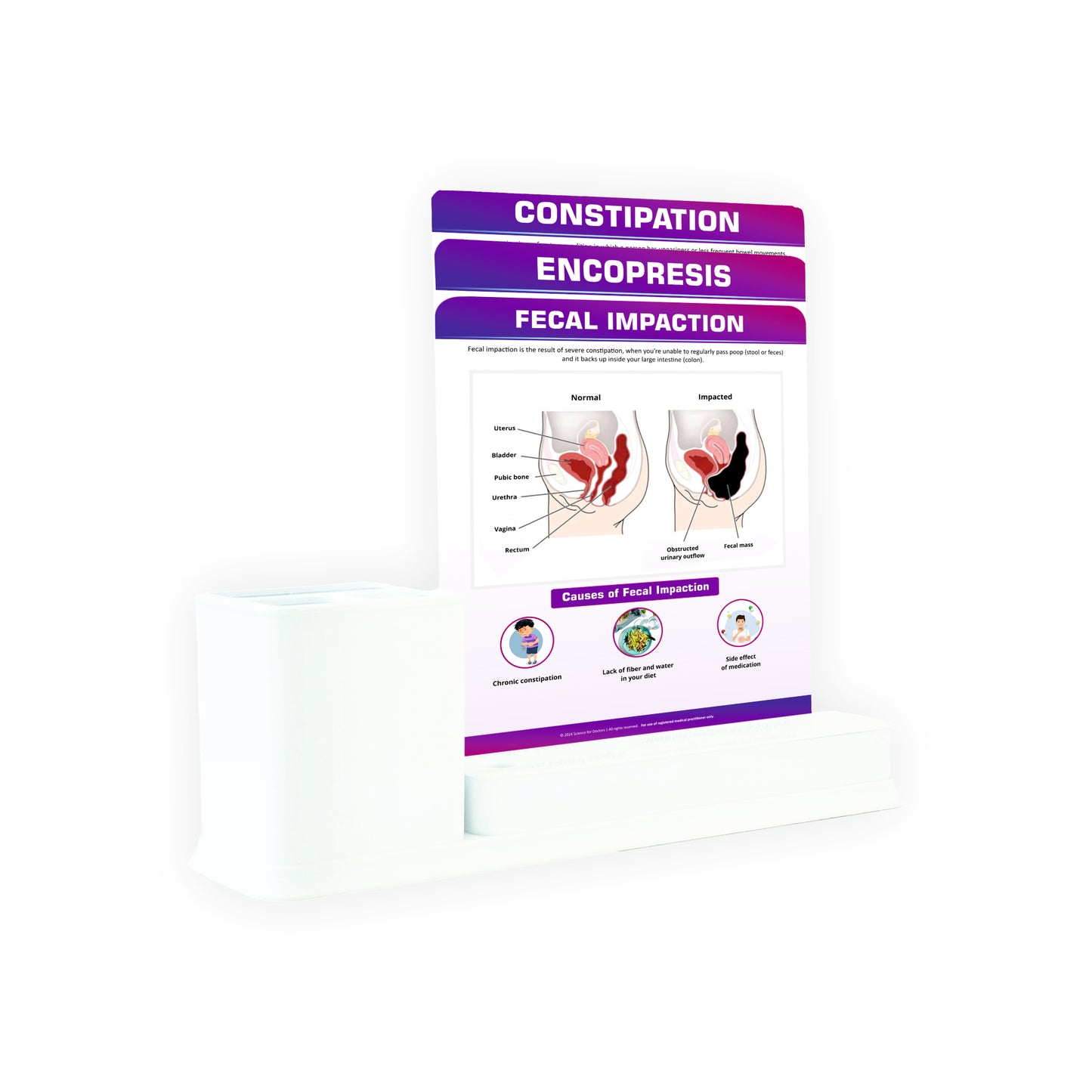 Fecal Impaction: 3 Slides Write & Wipe with Stationary Stand