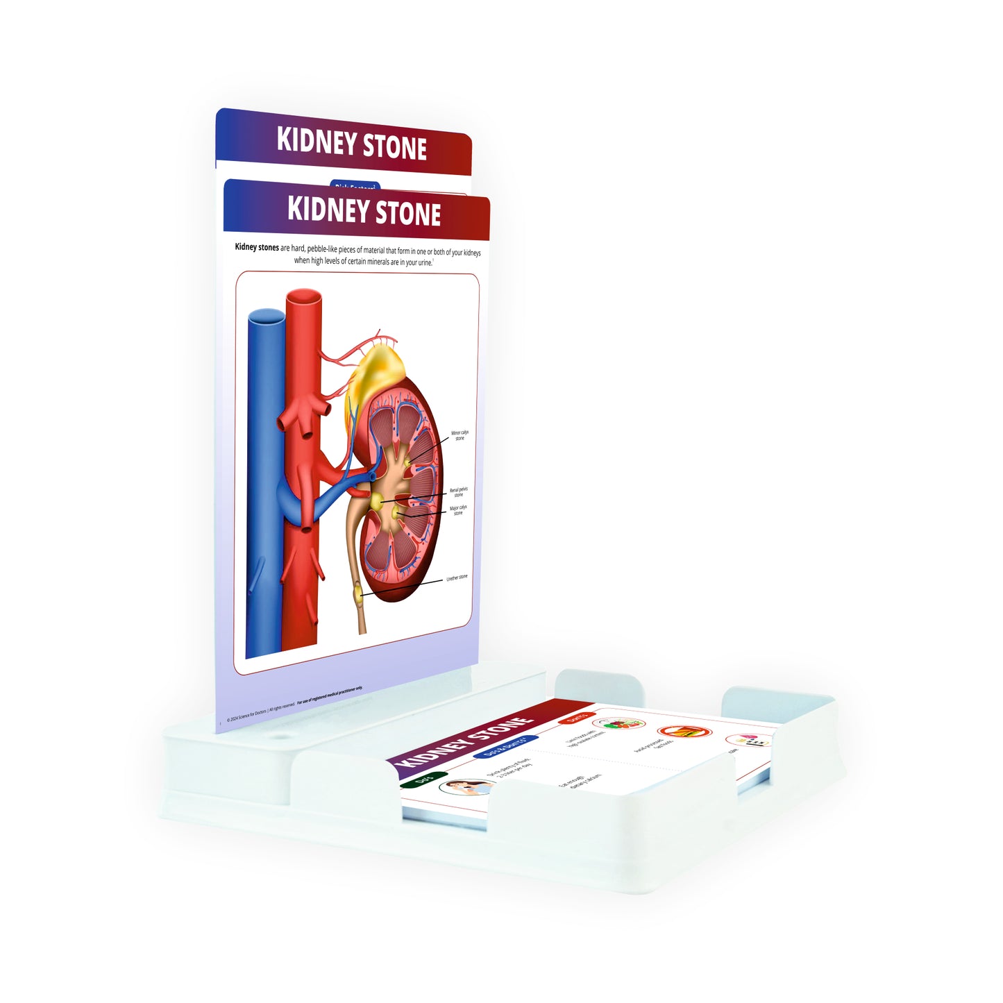 Kidney Stone : 2 Slides Patient Leaflet Tray