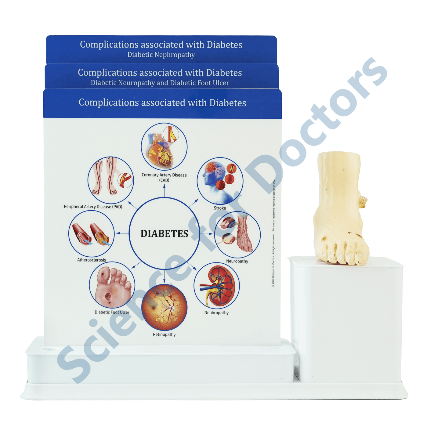 Diabetes Complication : 3 Slide Write and Wipe with Anatomical Model on Stand