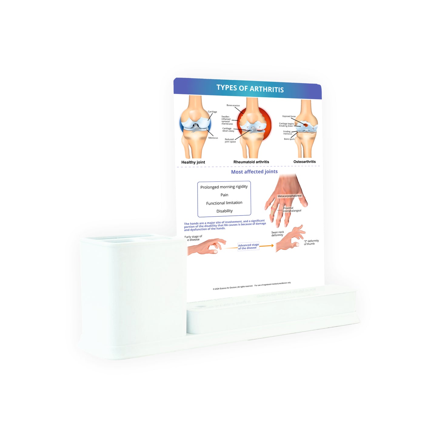 Types of Arthritis: 1 Slides Write & Wipe with Stationary Stand