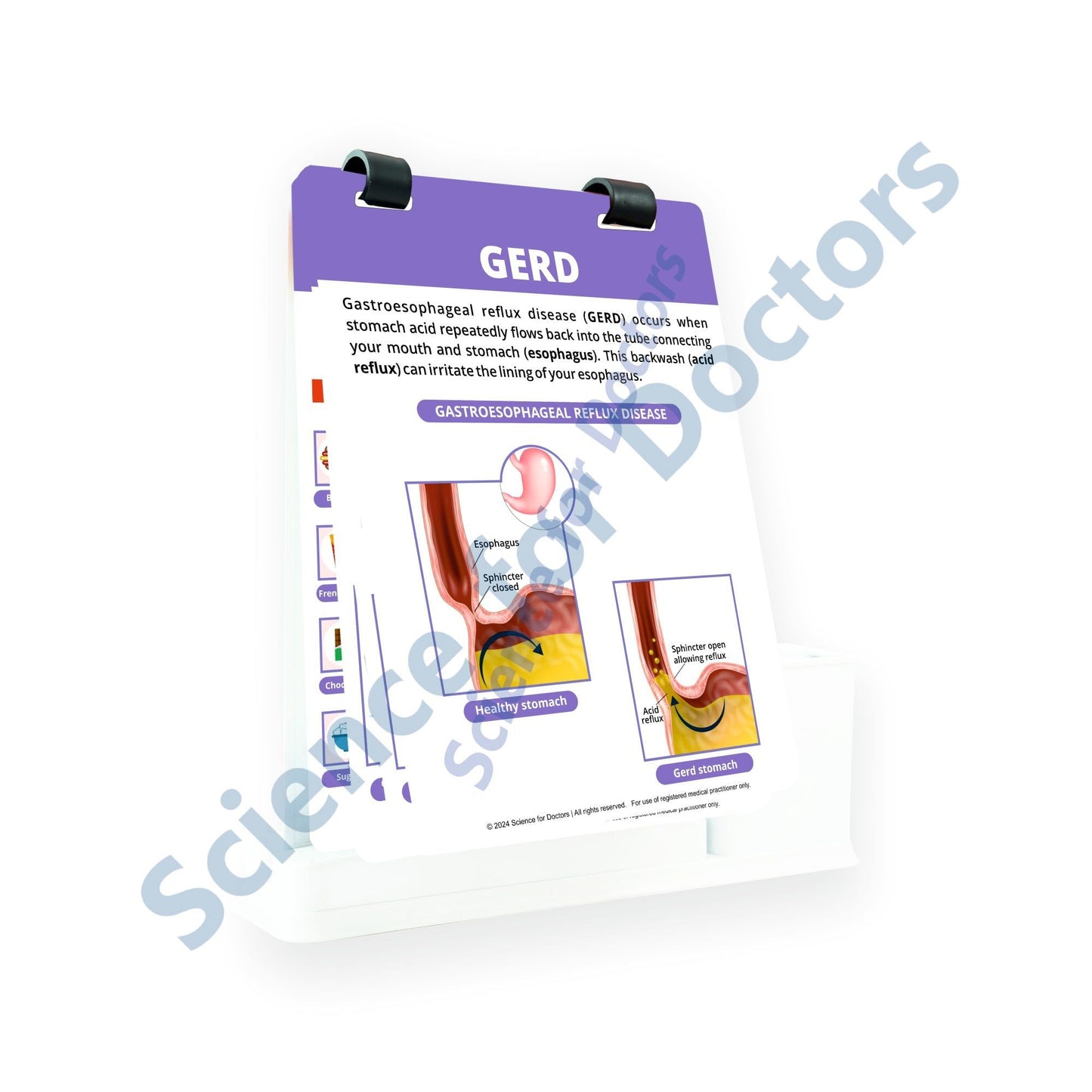 GERD: A4 Flip Wipe With Stationery Stand