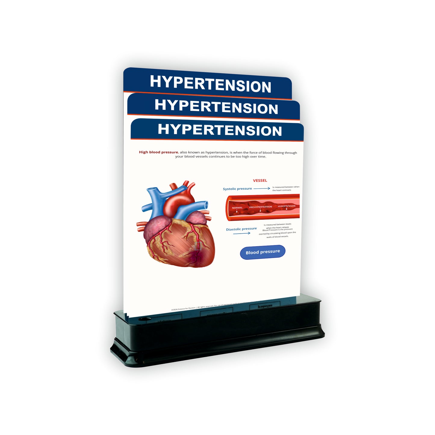 3 Slides on Stand  - Hypertension