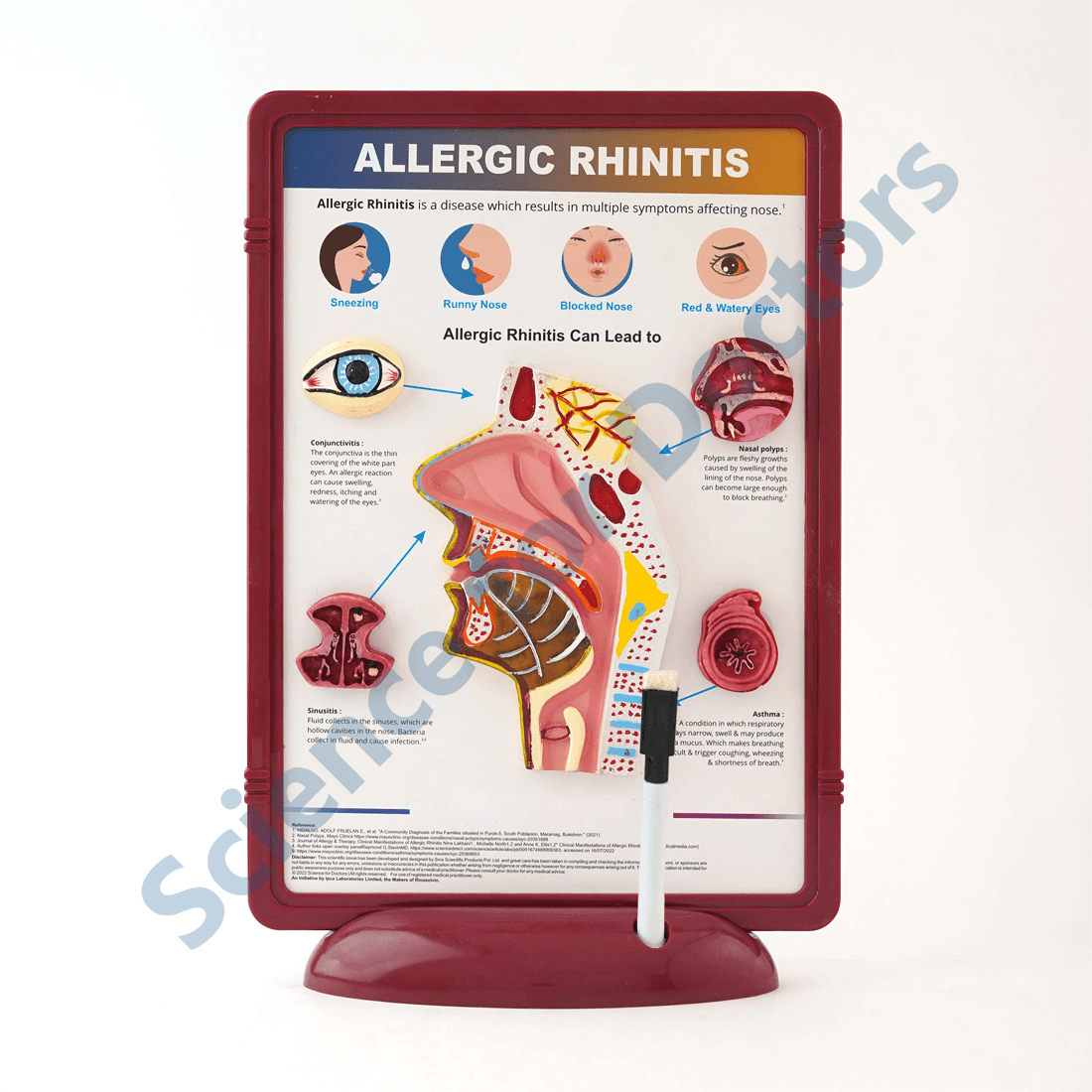 Allergic Rhinitis: 3D Therapy Frame