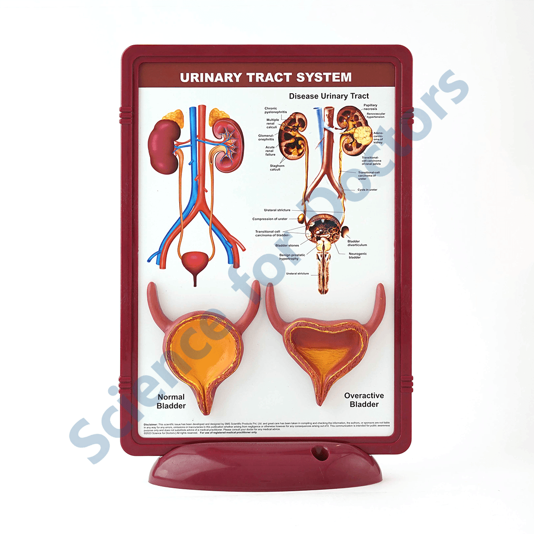 Urinary Tract System: 3D Therapy Frame