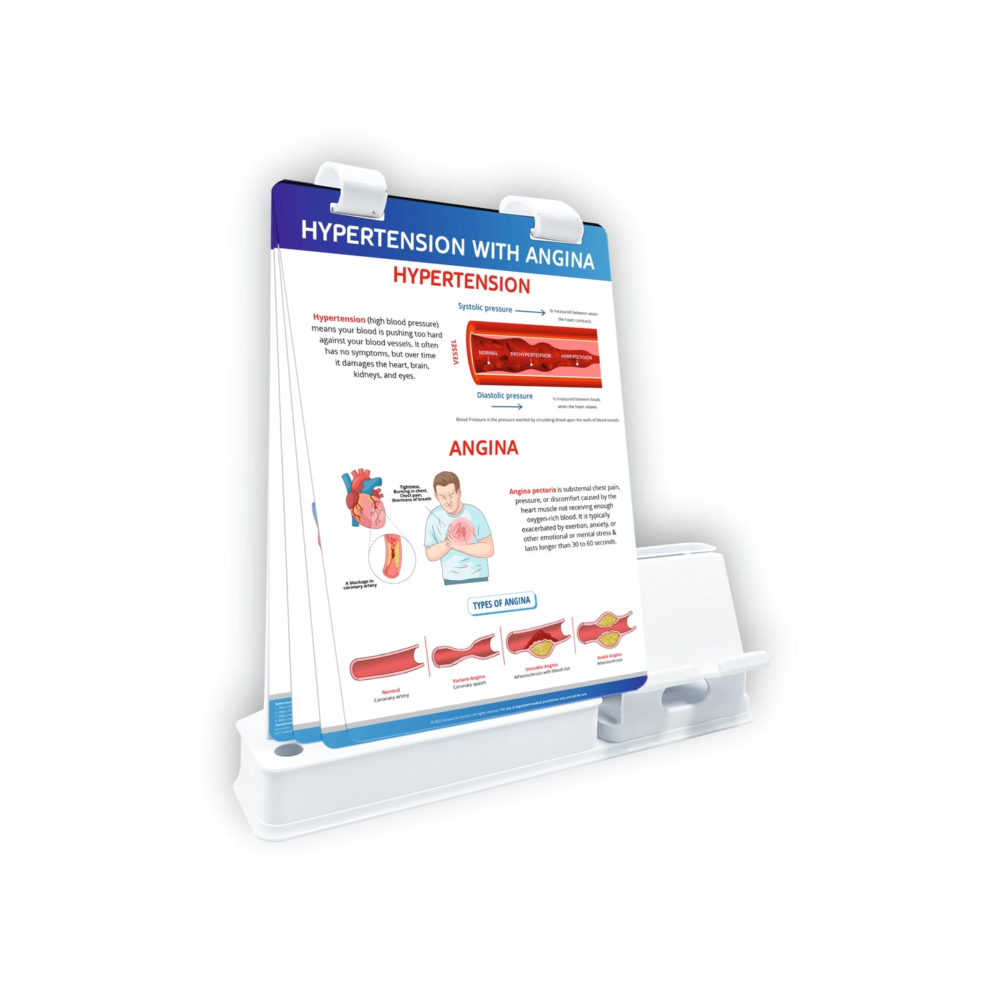 Smart -A5 Flip wipe With Mobile and Chit Pad Stand  - HYPERTENSION WITH ANGINA