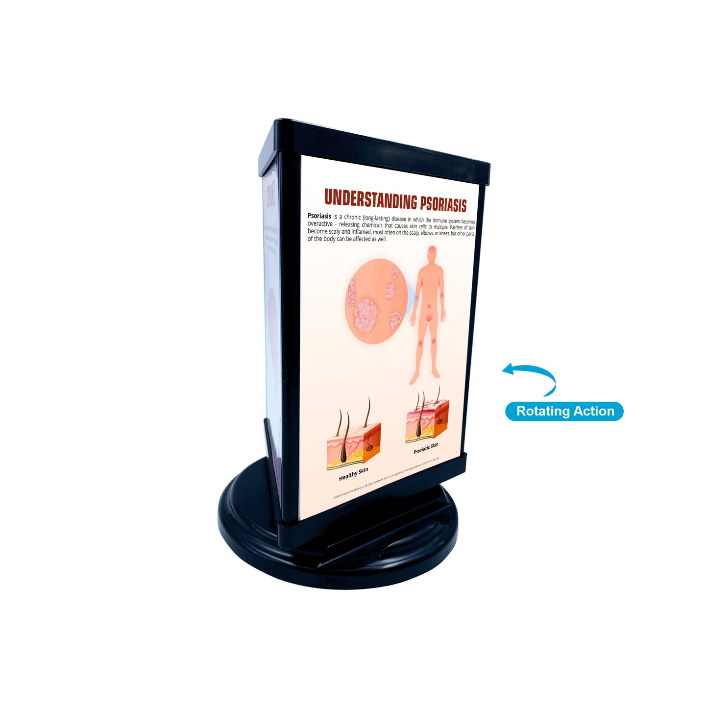 Rotri V - Understanding PSORIASIS