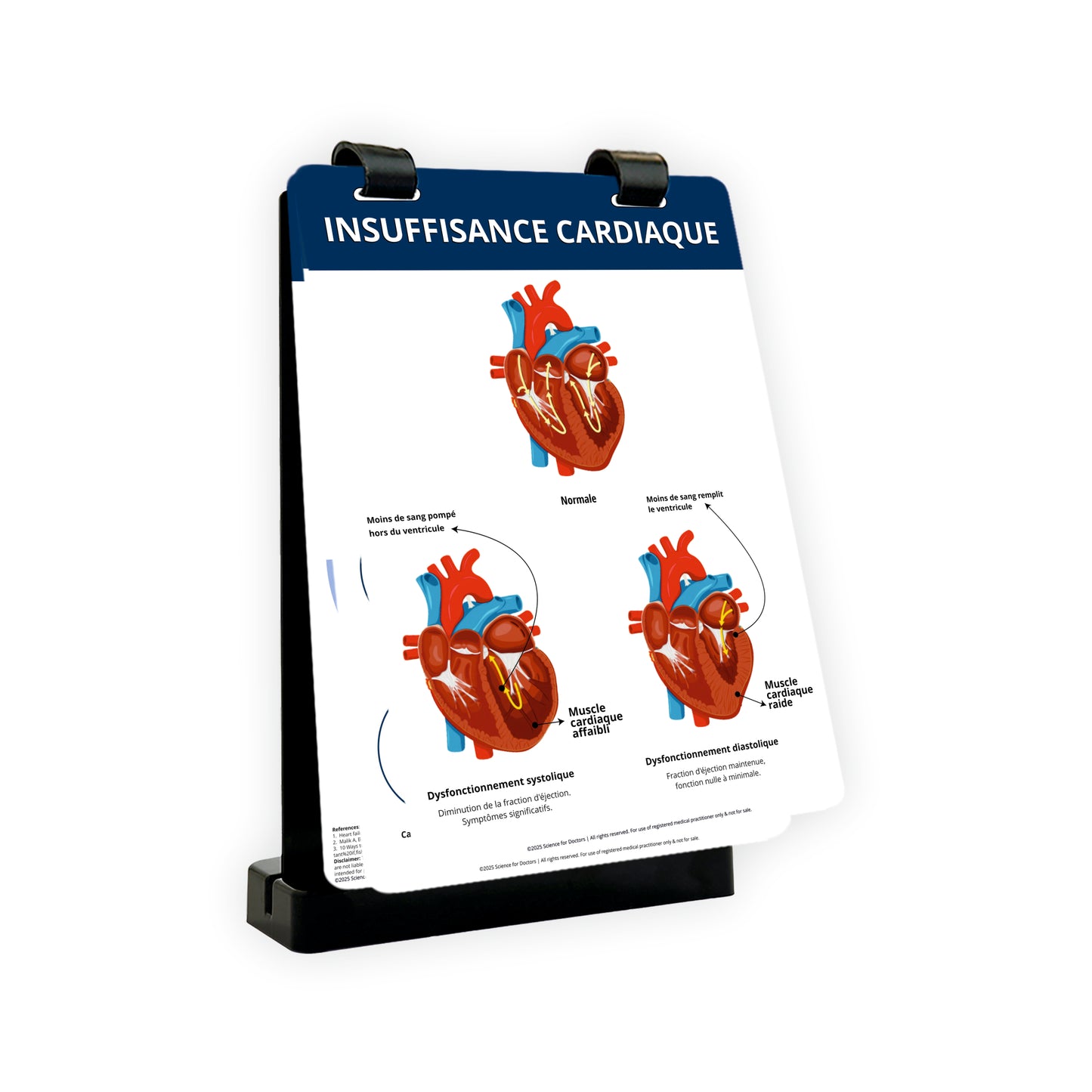Insuffisance Cardiaque: A4 Flip Wipe