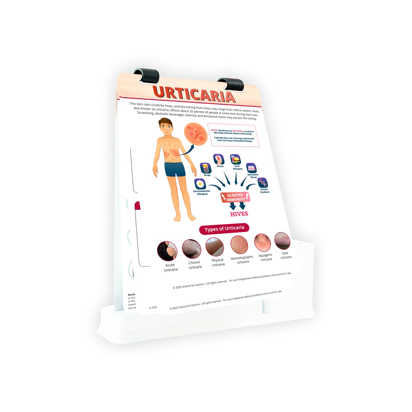 Urticaria: A4 Flip Wipe With Stationery Stand