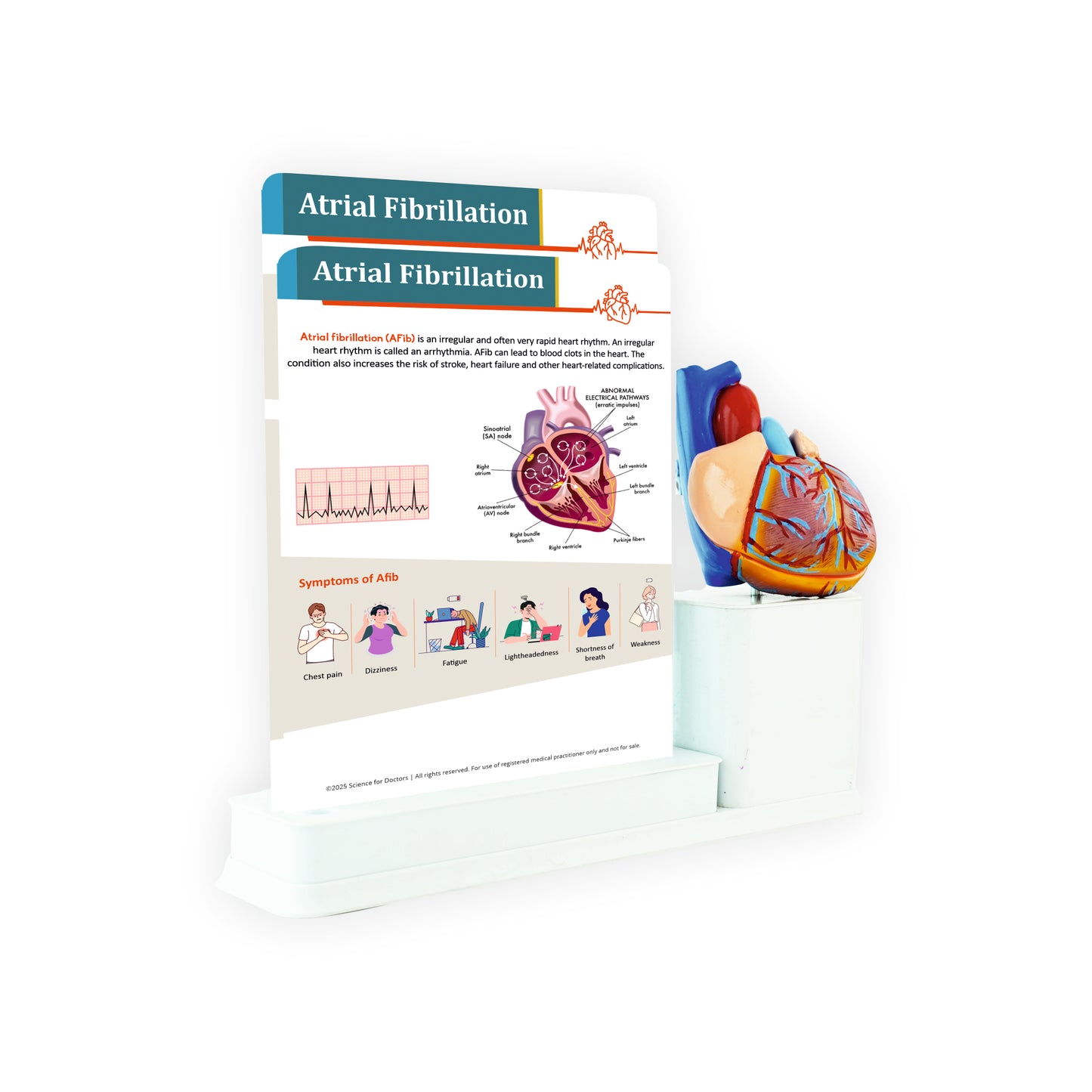 Atrial Fibrillation: 2 Slides Write & Wipe With Model On Stand