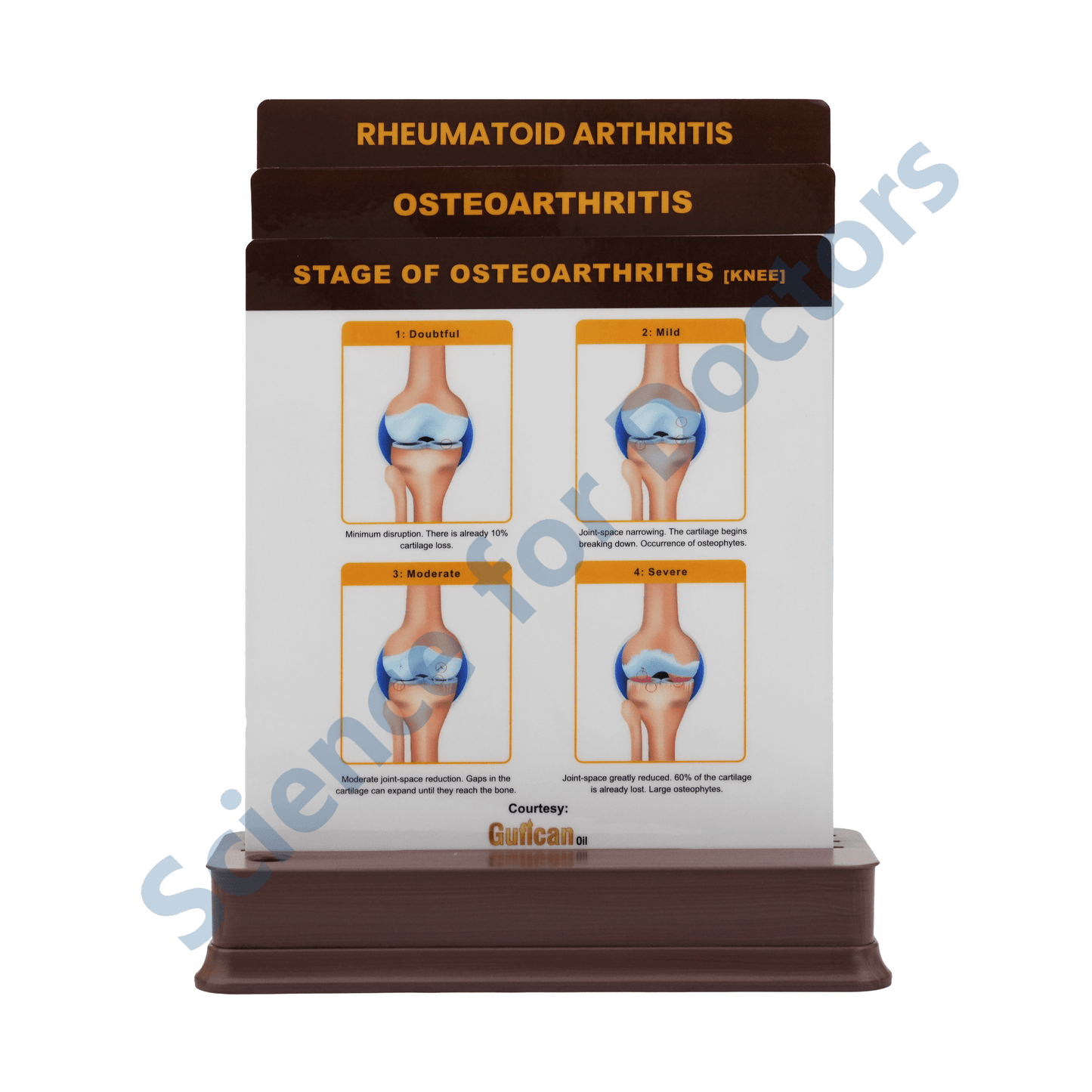 Osteoarthritis: 3 slide on stand