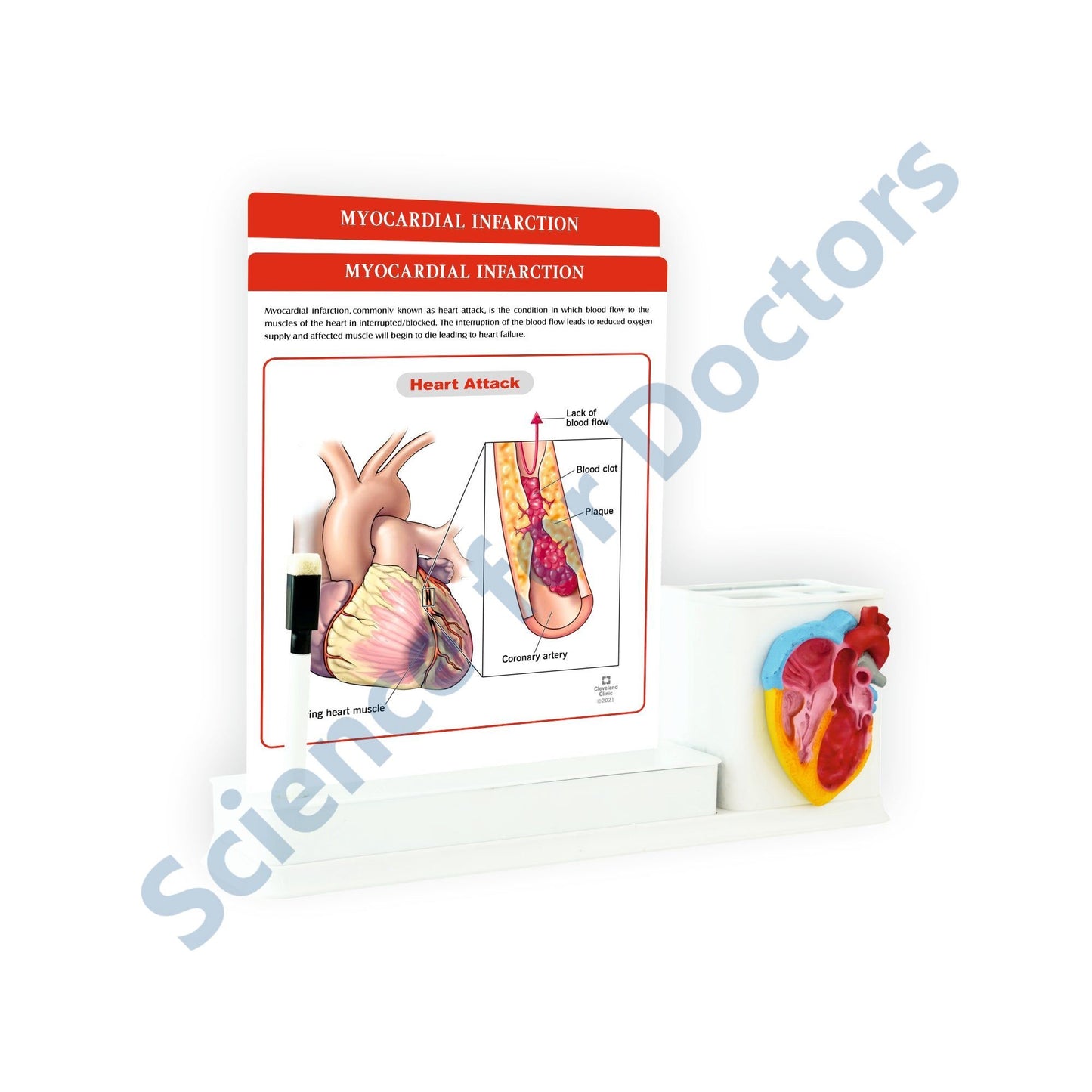 2 slides write & wipe with anatomical model on Stationary Stand - Myocardial Infarction_1