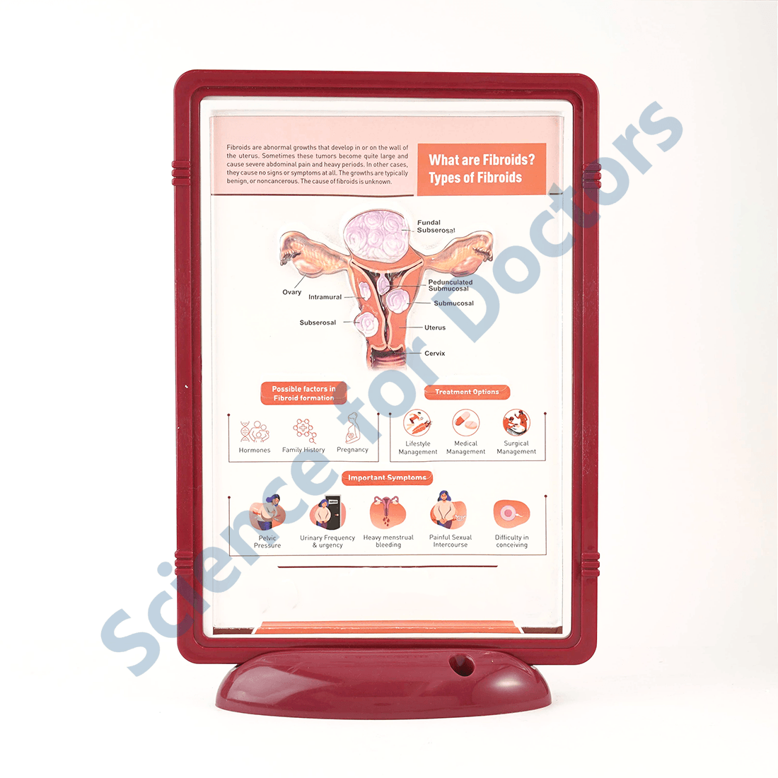 Fibroids: 3D Pop Up Frame* (MOQ 300)