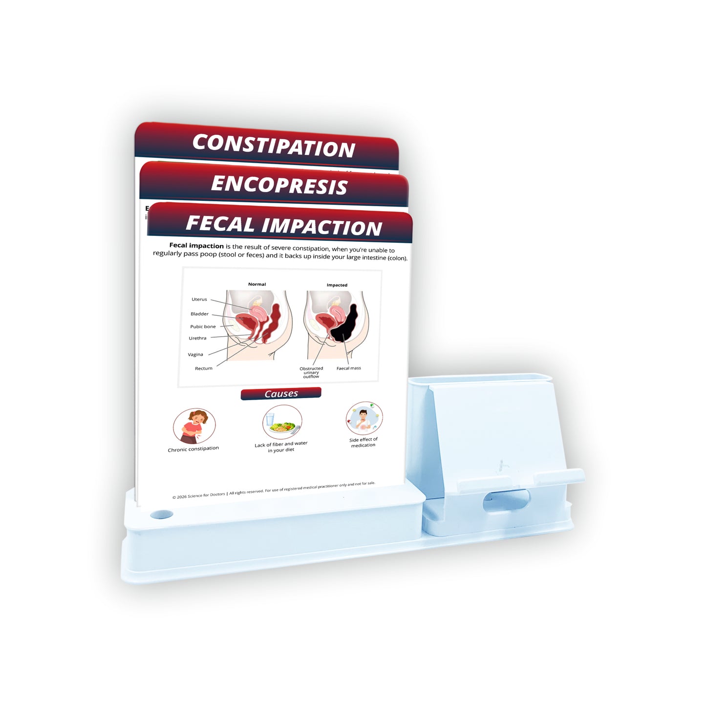 Smart - 3 Slides Write & Wipe With Mobile and Chit pad Stand - Fecal Impaction