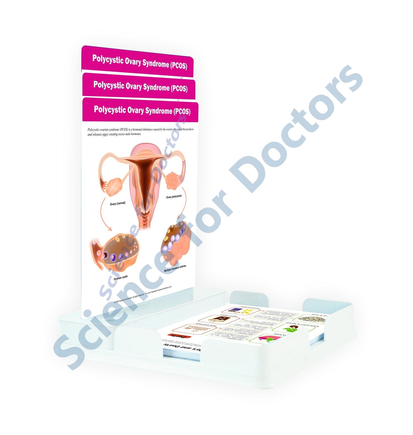 Polycystic Ovary Syndrome (PCOS): 3 Slides Patient Leaflet Tray