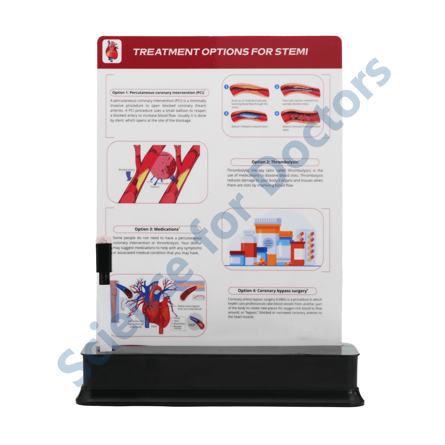 Treatment Options For STEMI: 1 Slide on stand