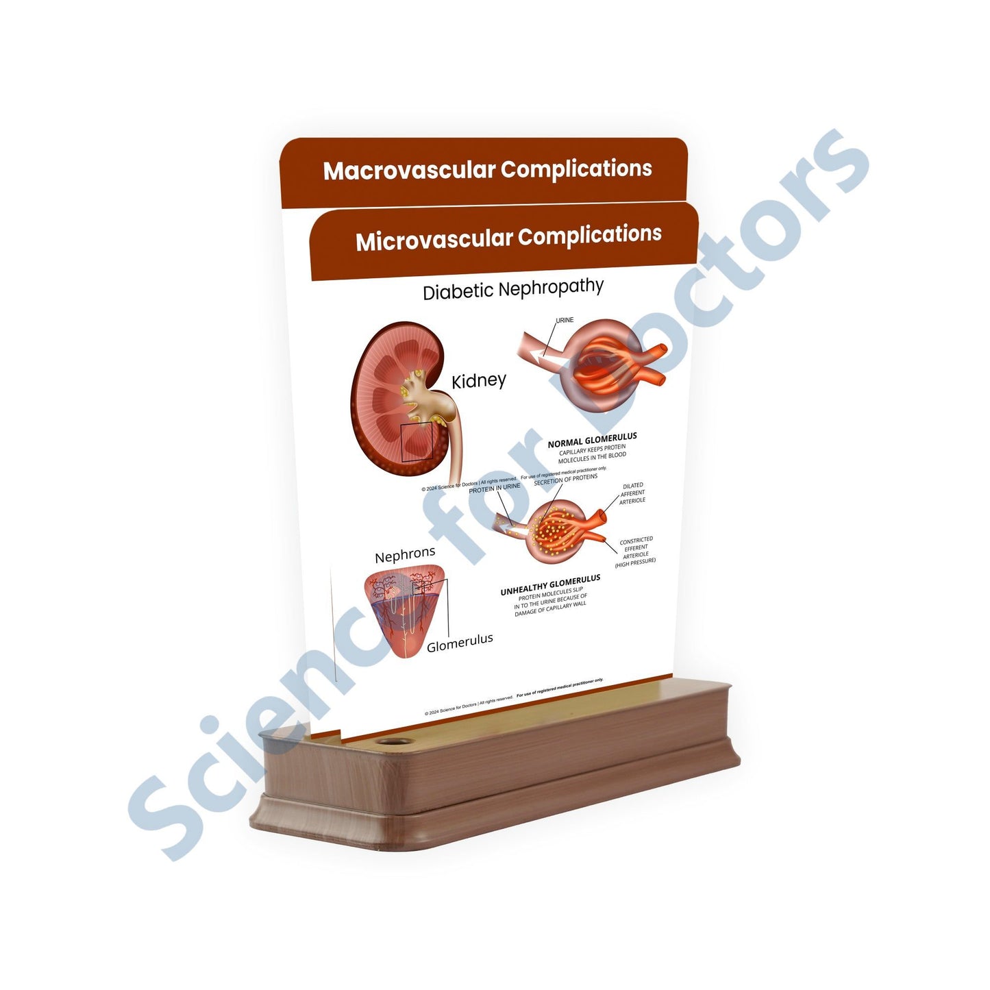 Microvascular Complications: 2 Slides on stand