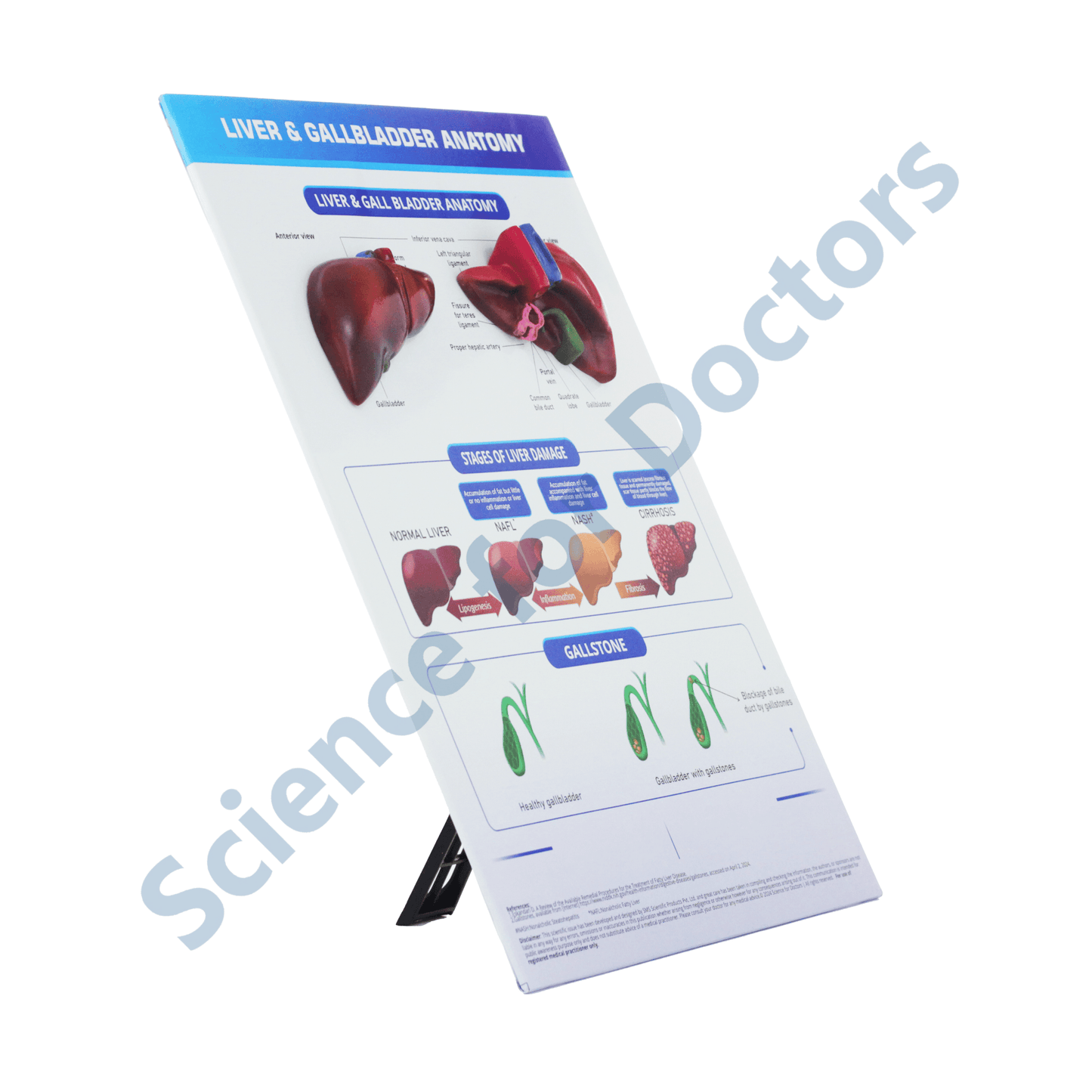 Liver & Gall Bladder Anatomy: 3D therapy Board