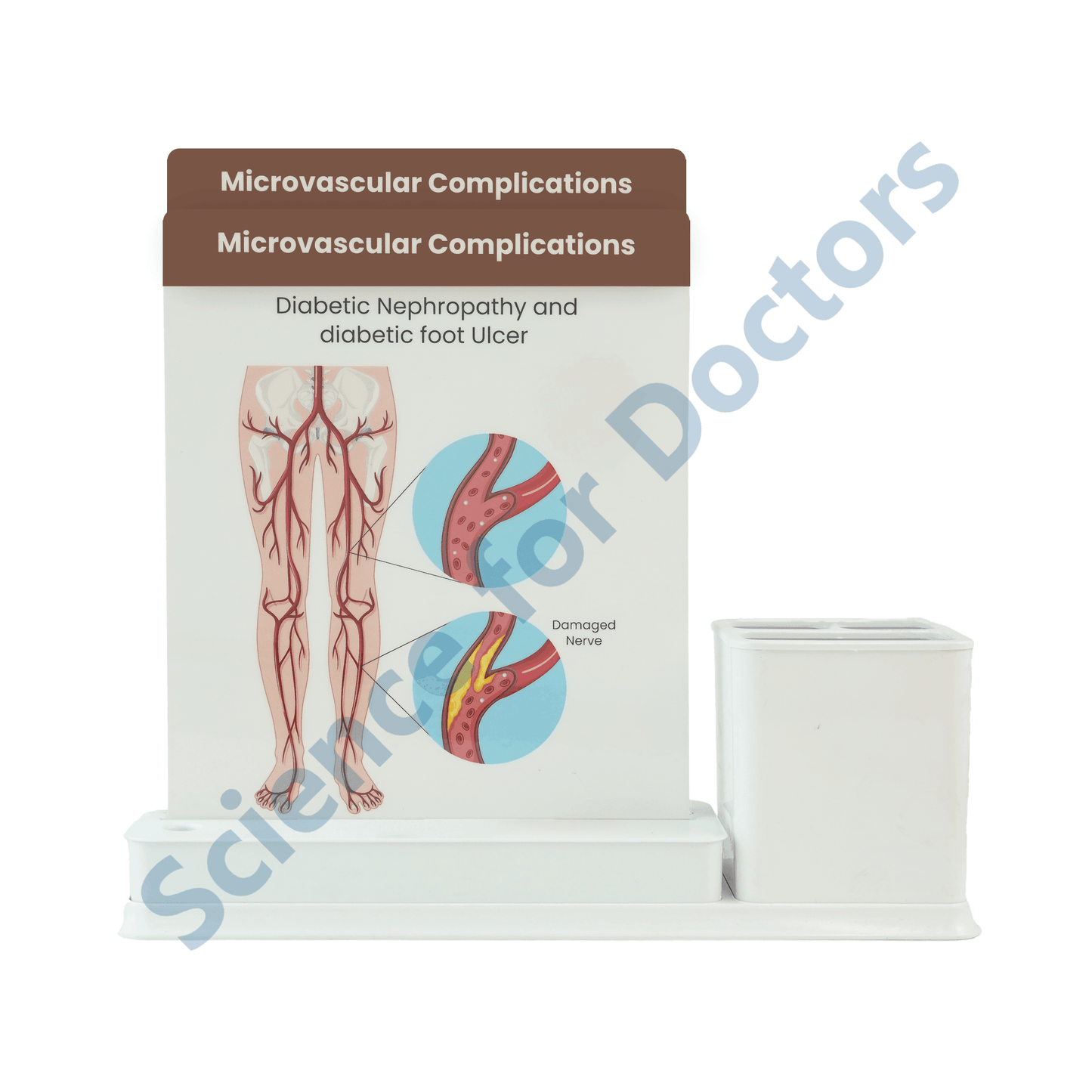 Microvascular Complications: 2 slide on stand with Stationary stand