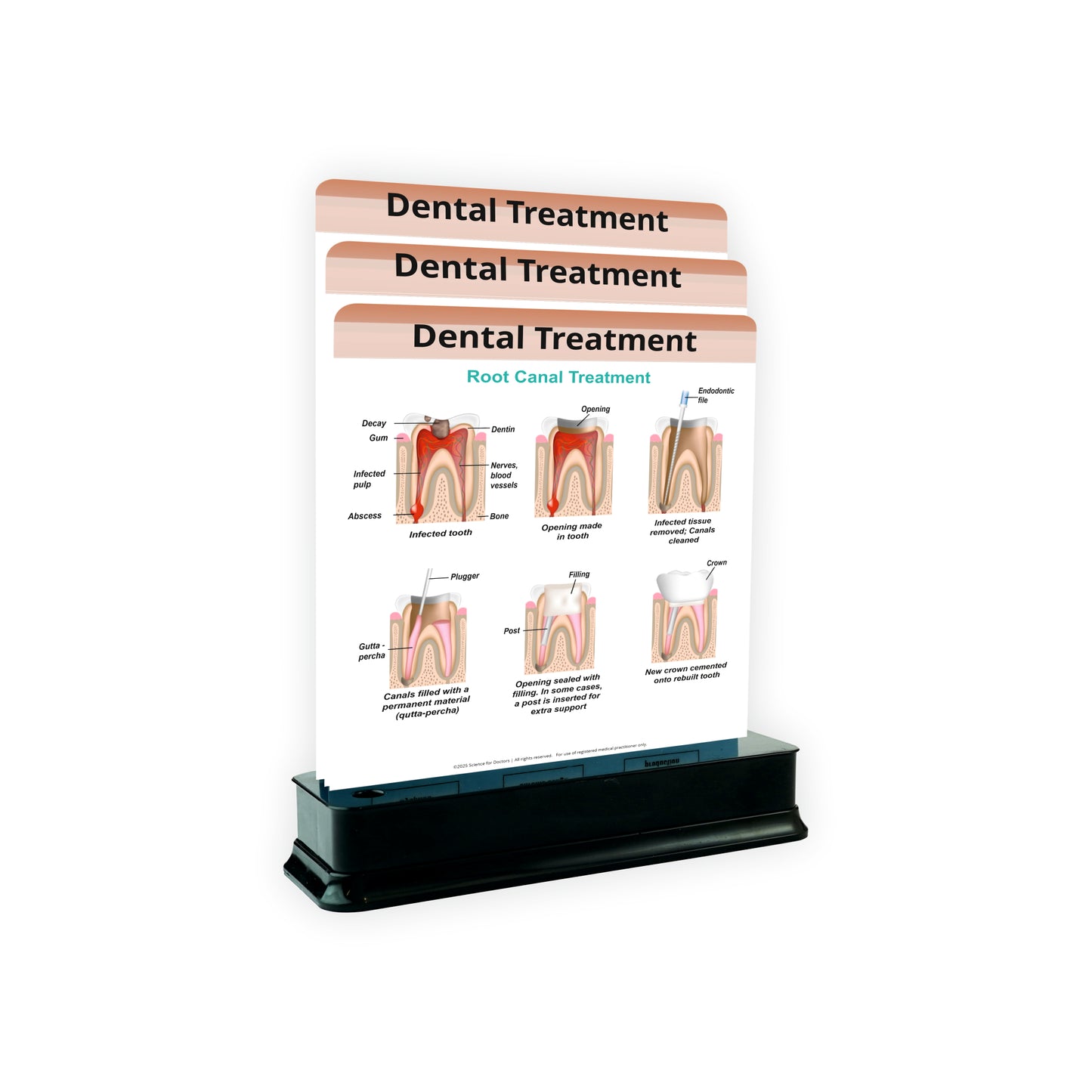 3 Slides on Stand  -  Dental Treatment