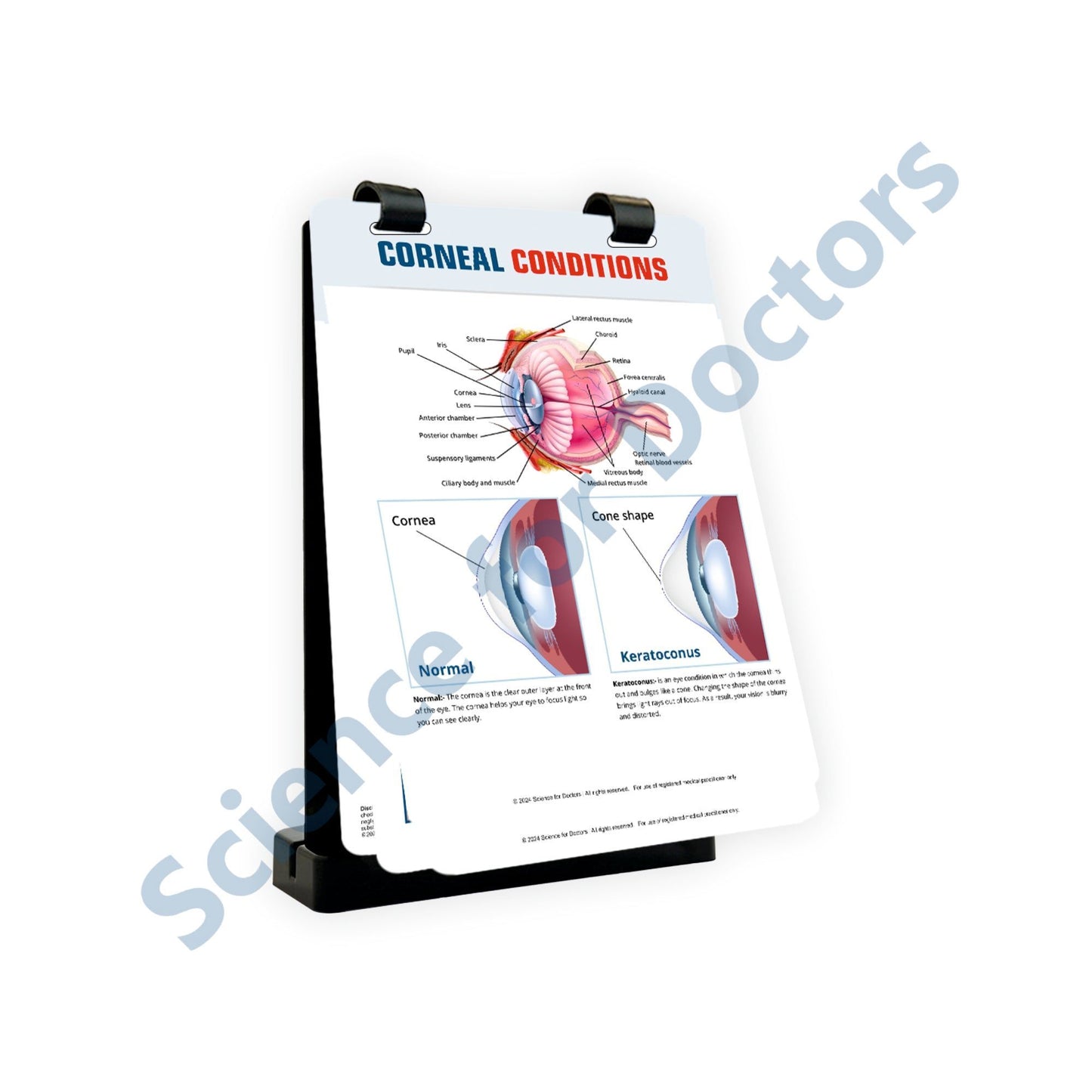 Corneal Conditions: A4 Flip Wipe