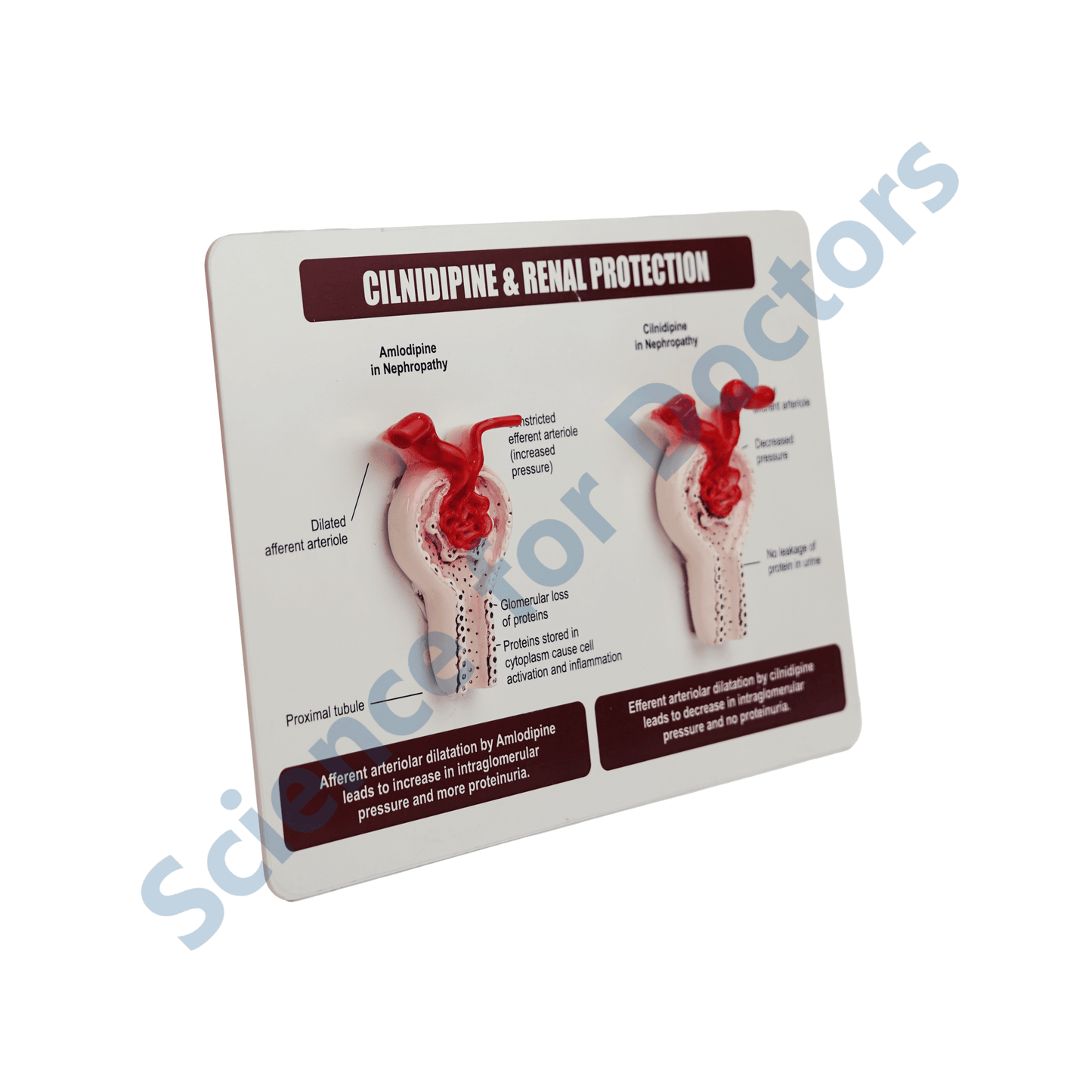 Cilnidipine & Renal Protection: 3d therapy Board