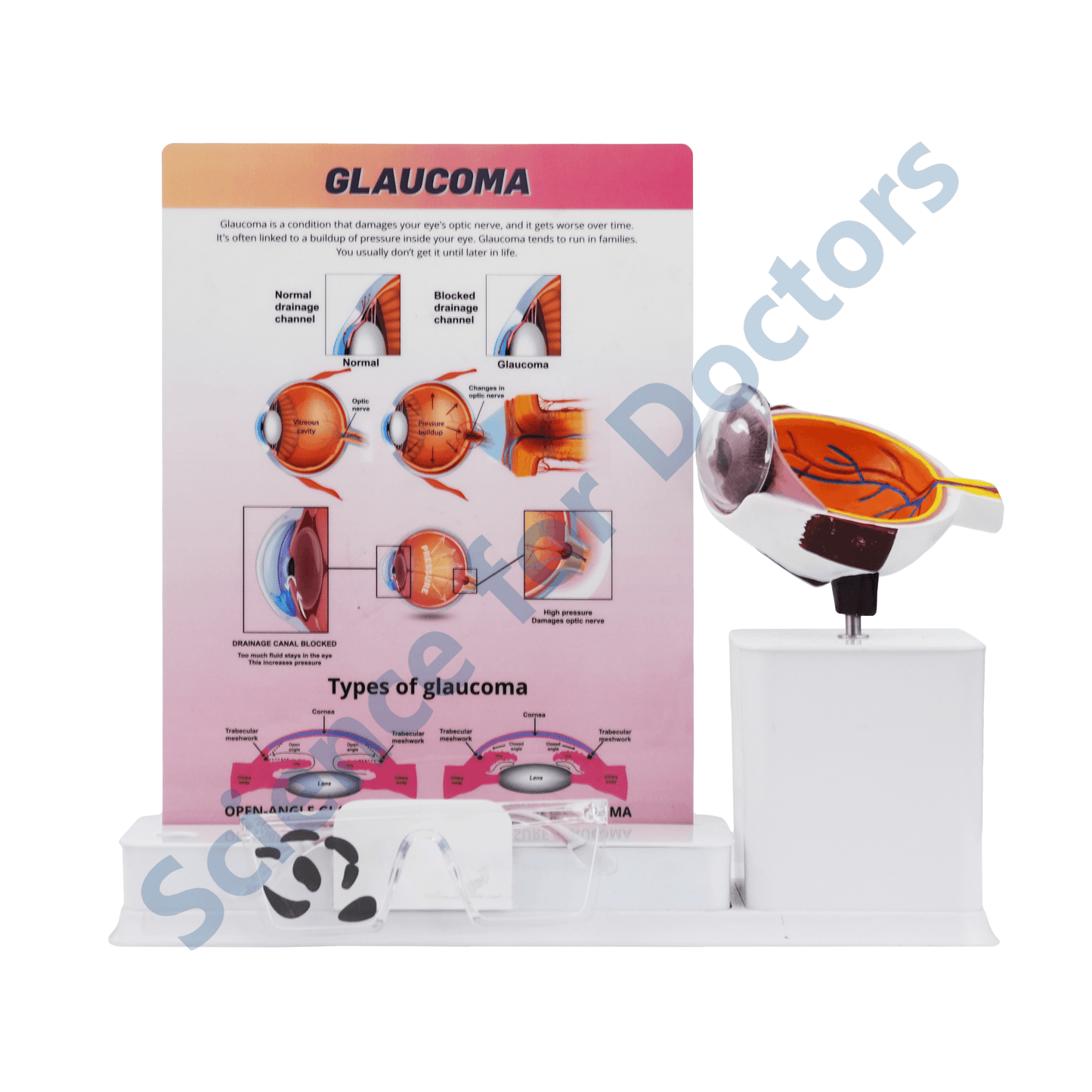 Glaucoma : 1 Slide write and wipe with anatomical model on stand