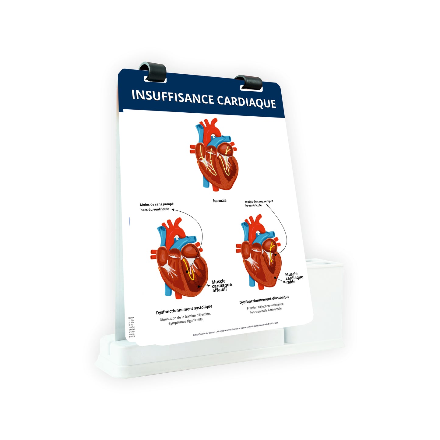 Insuffisance Cardiaque: A4 Flip wipe With Stationery Stand
