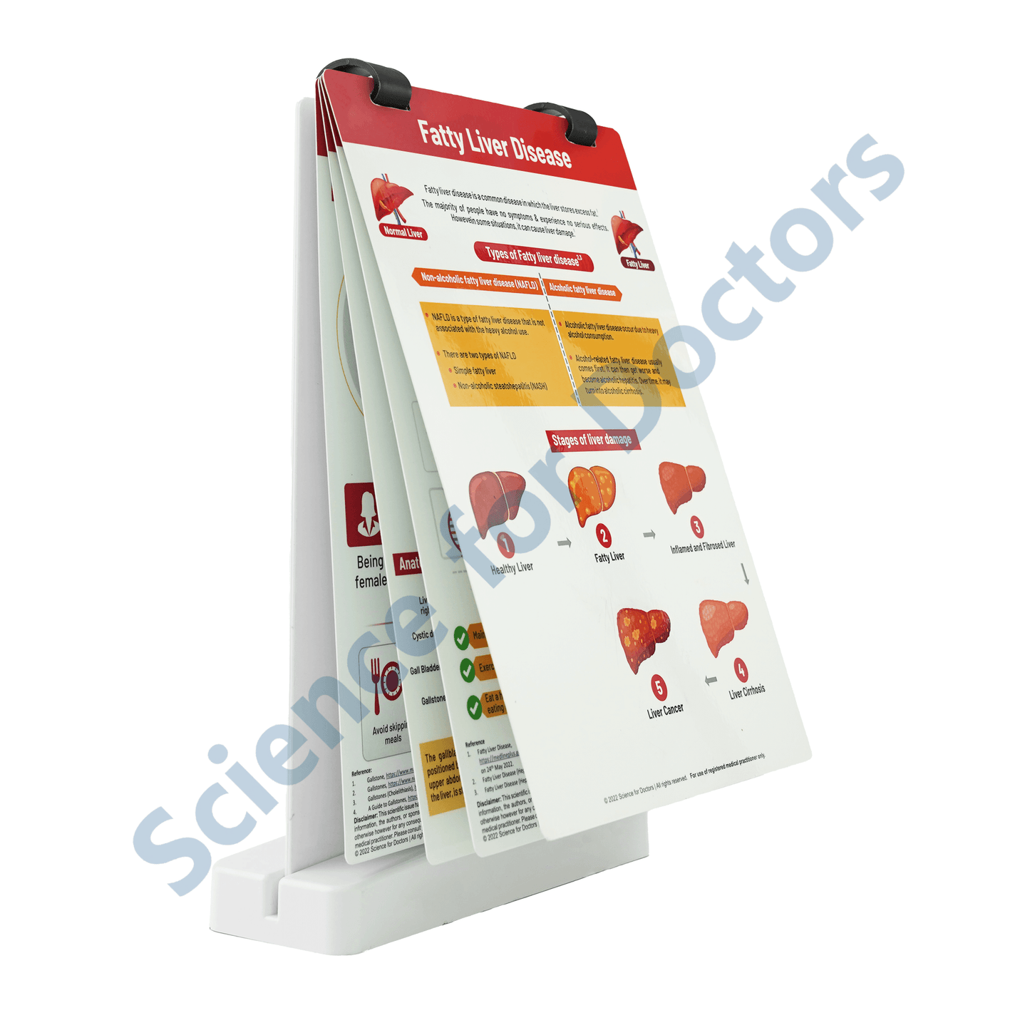 Fatty Liver Disease: A4 Flip Wipe with 3D Therapy Board