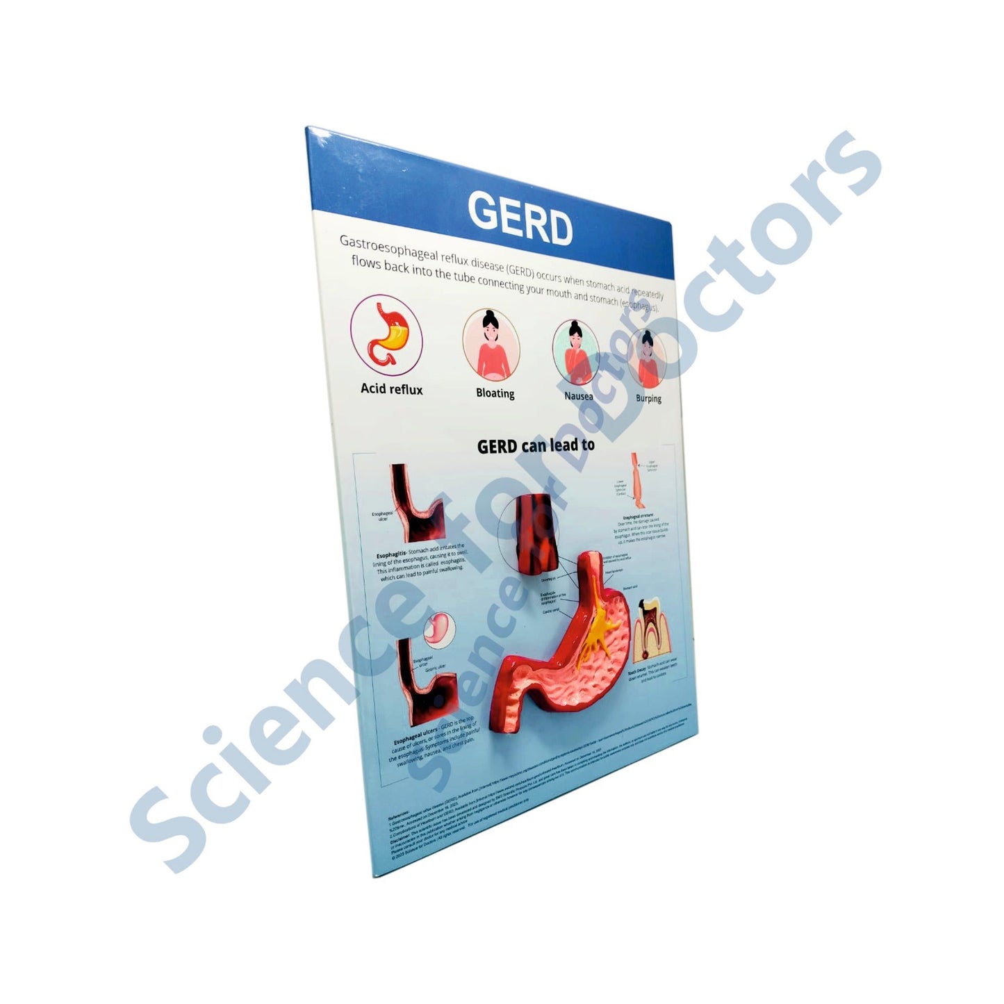 GERD: 3D Therapy Board