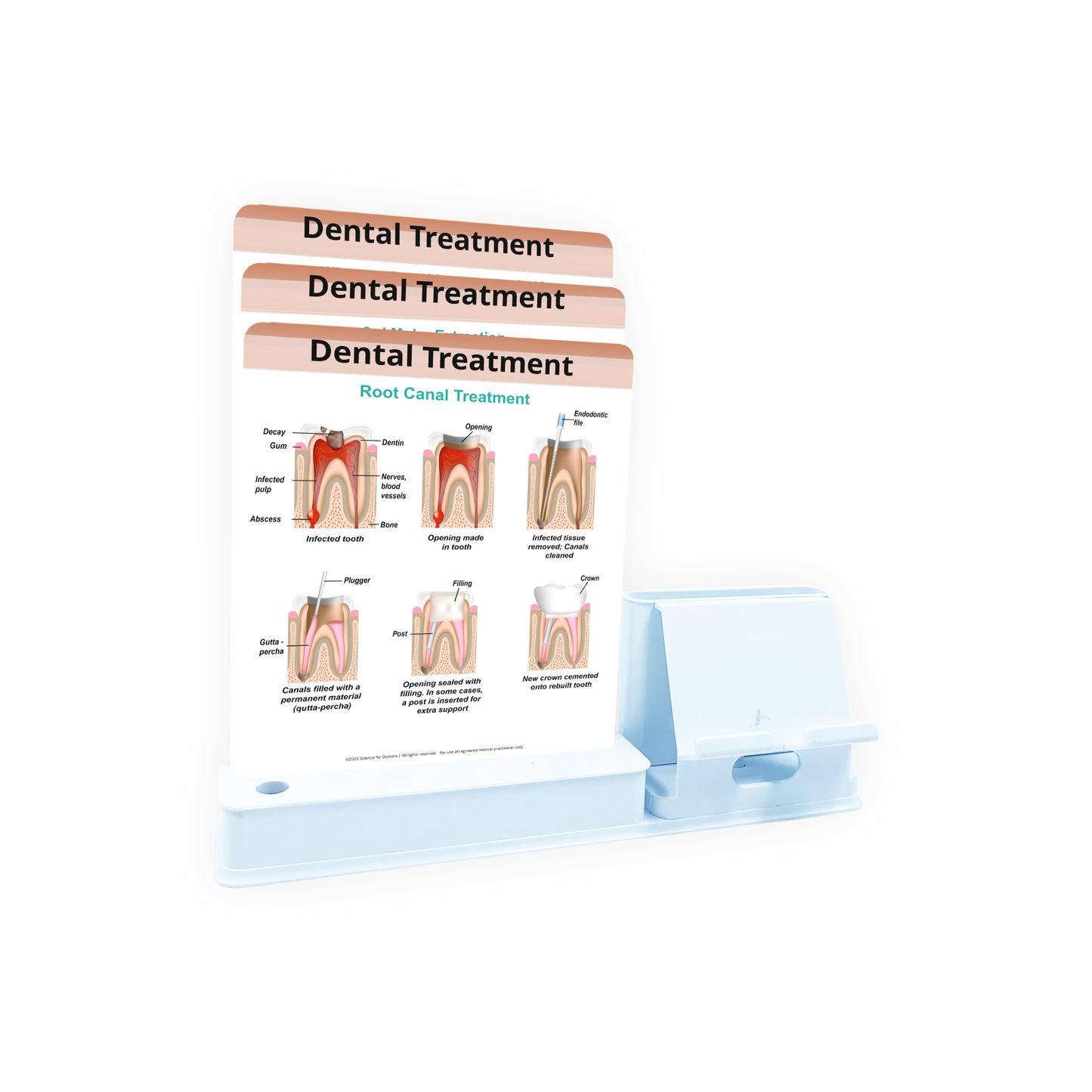 Smart - 3 Slides Write & Wipe With Mobile and Chit pad Stand - Dental Treatment