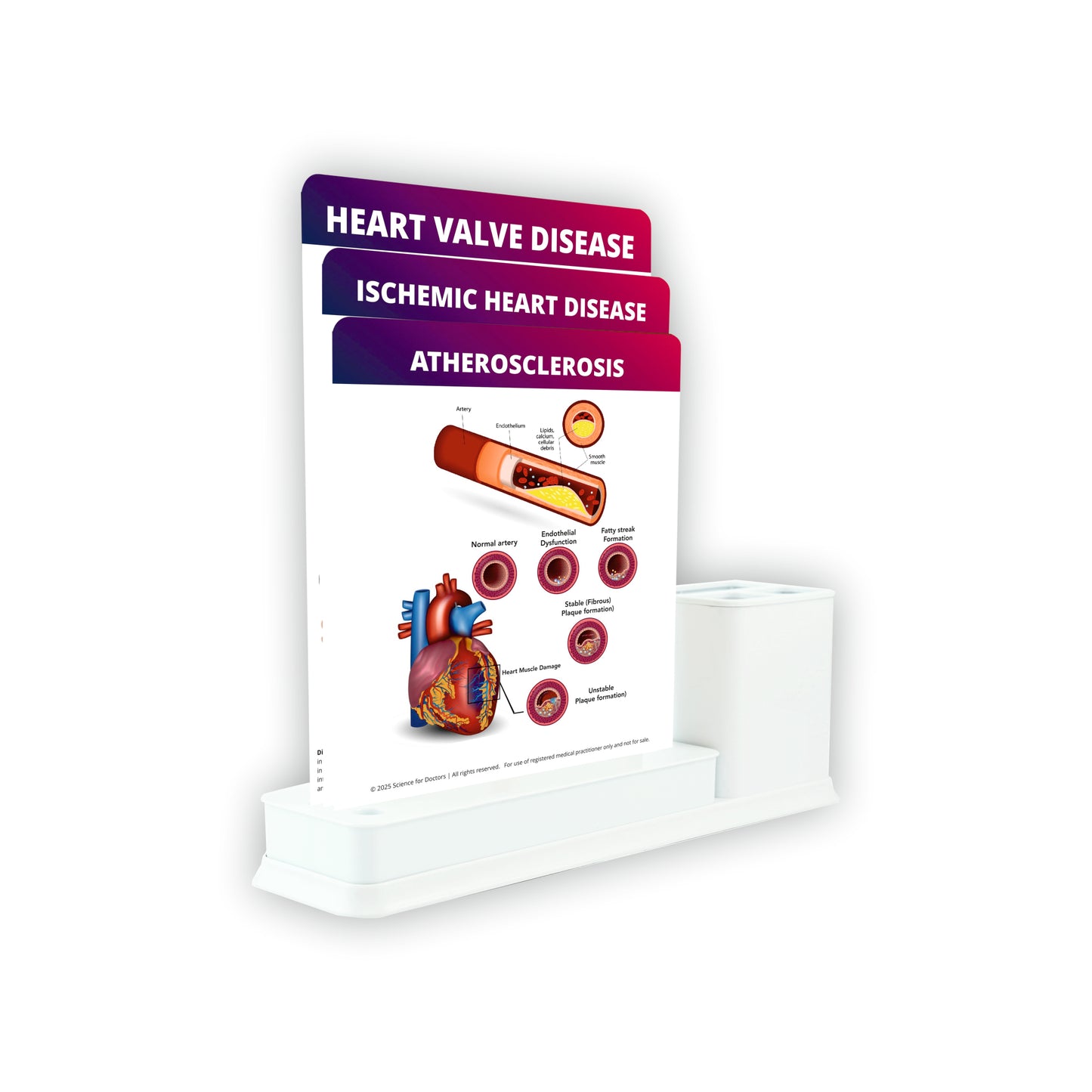 Plaque Rupture and Thrombosis: 3 Slides Write & Wipe with Stationary Stand