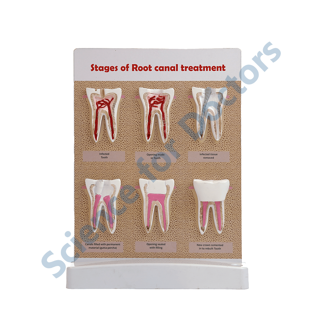 Stages of root canal treatment: 3D Therapy Board On Stand