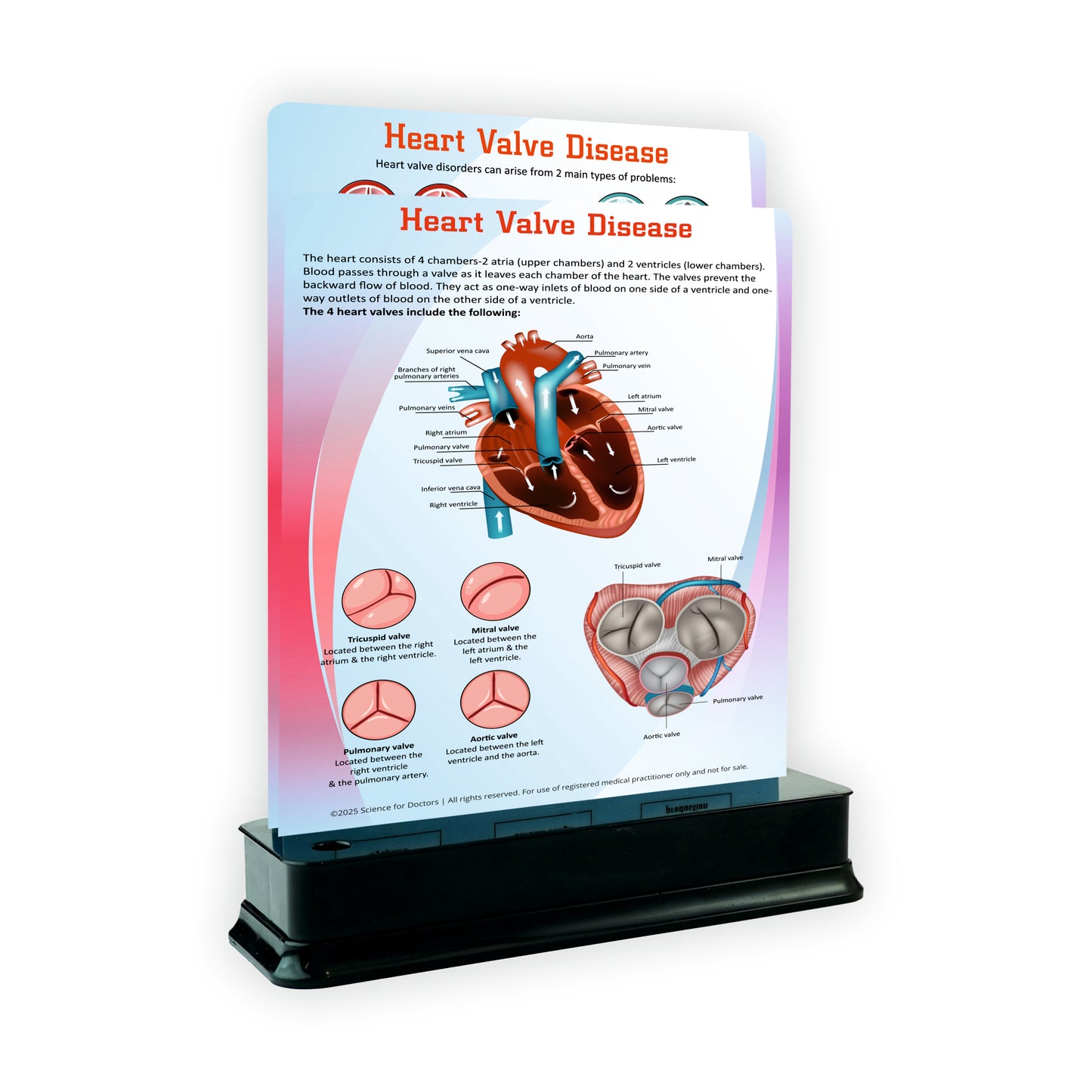 Heart Valve Disease: 2 Slide With Stand