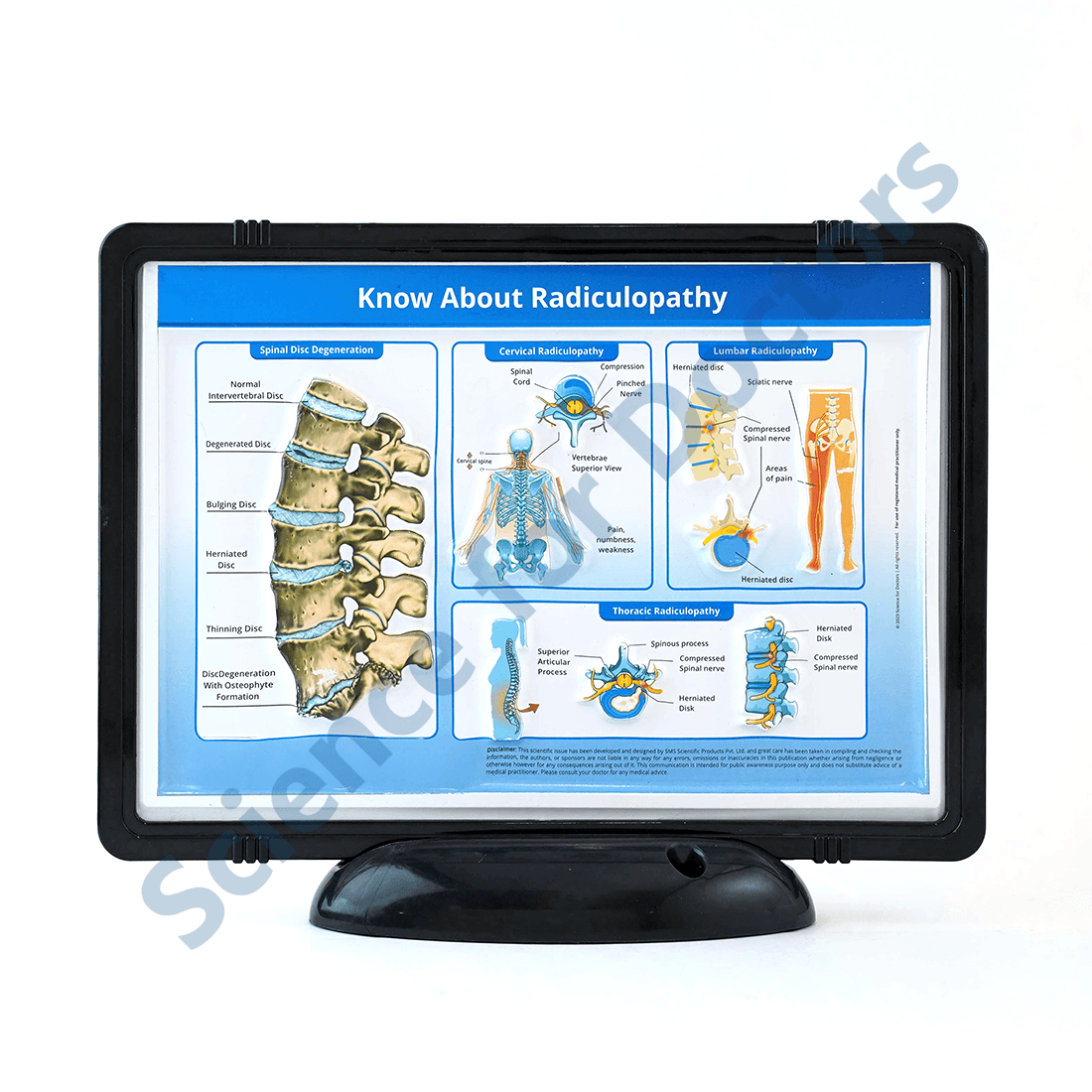 Know about Radiculopathy: 3D Pop Up Frame* (MOQ 300)