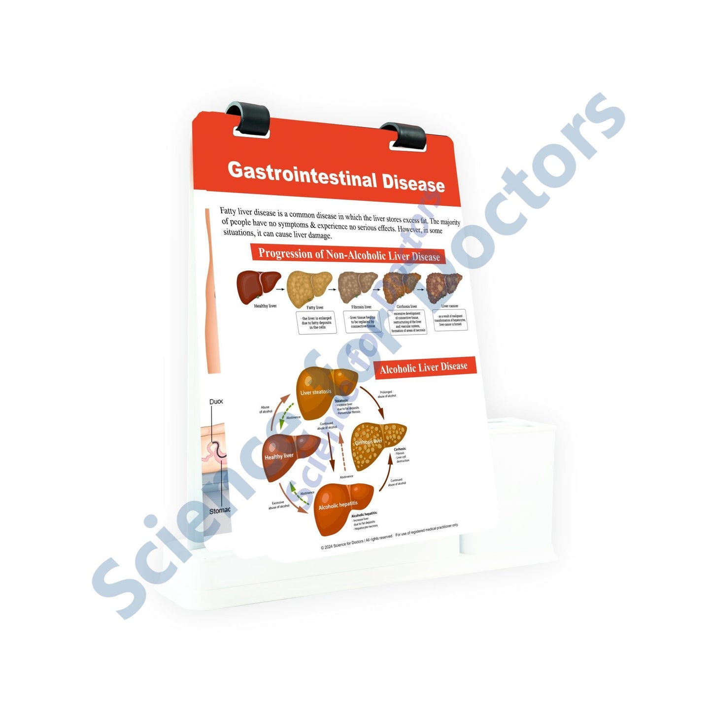 Gastrointestinal Disease: A4 Flip Wipe With Stationery Stand