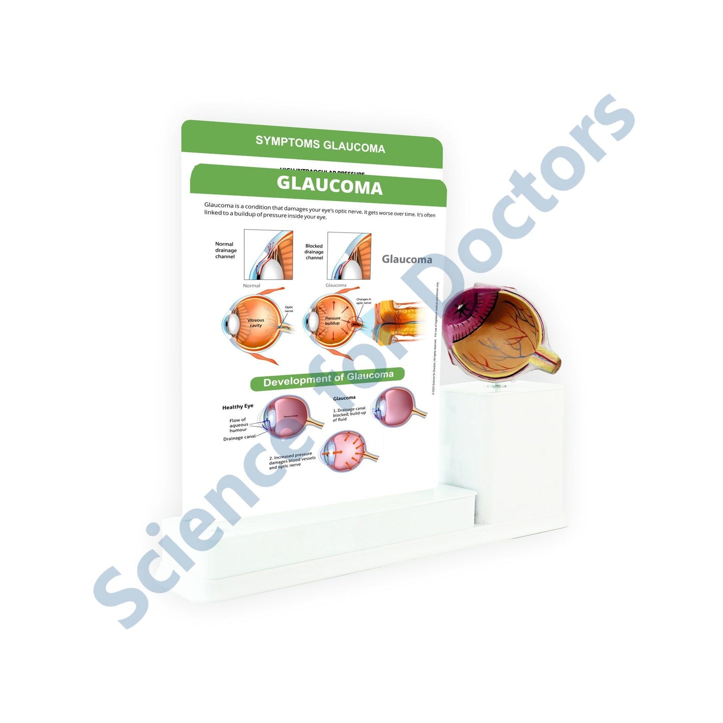 2 Slides Write and Wipe with Model On Stand - Glaucoma