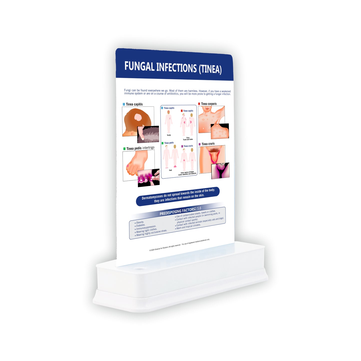 Fungal Infections (Tinea): 1 Slide with Stand