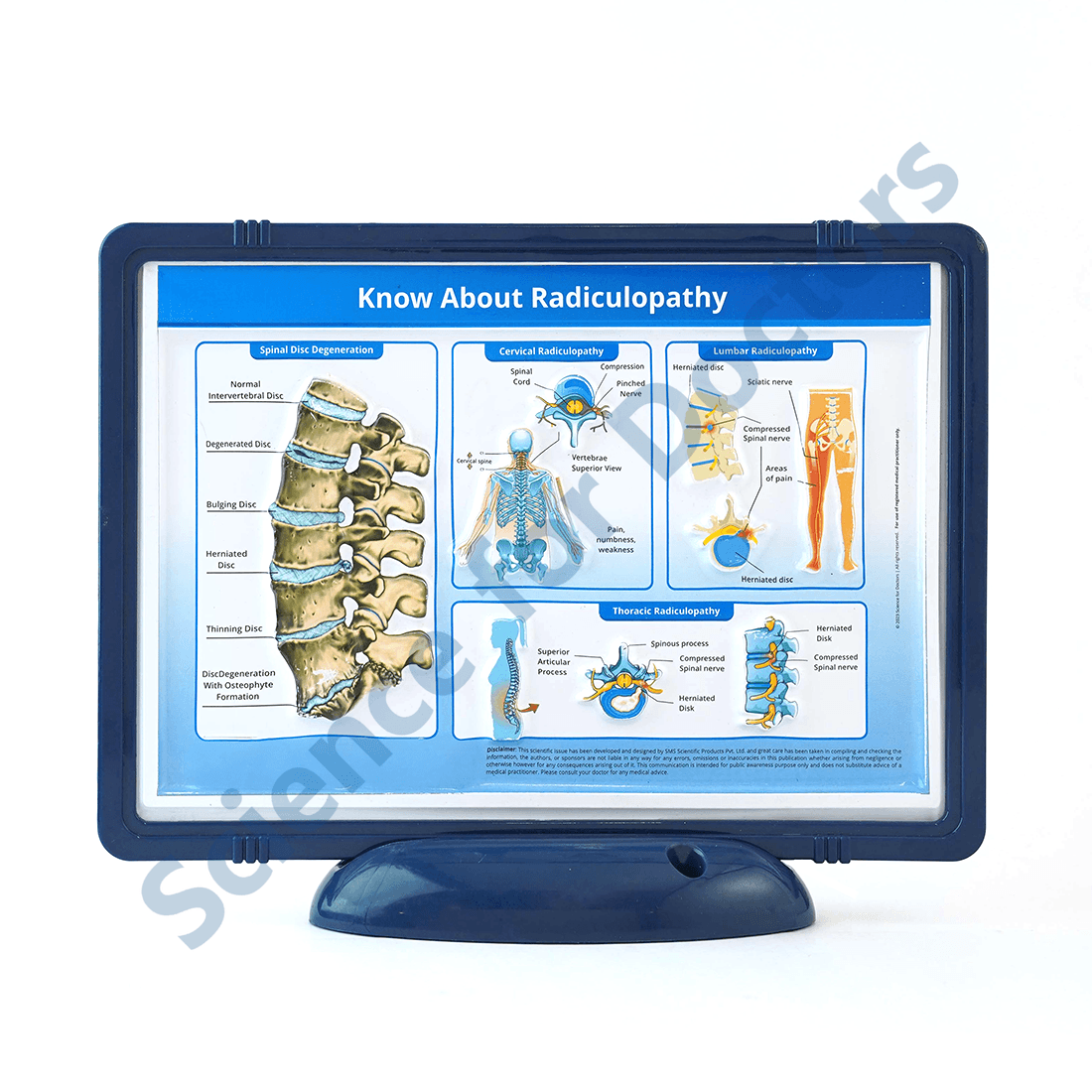 Know about Radiculopathy (With Light): 3D Pop Up Frame* (MOQ 300)