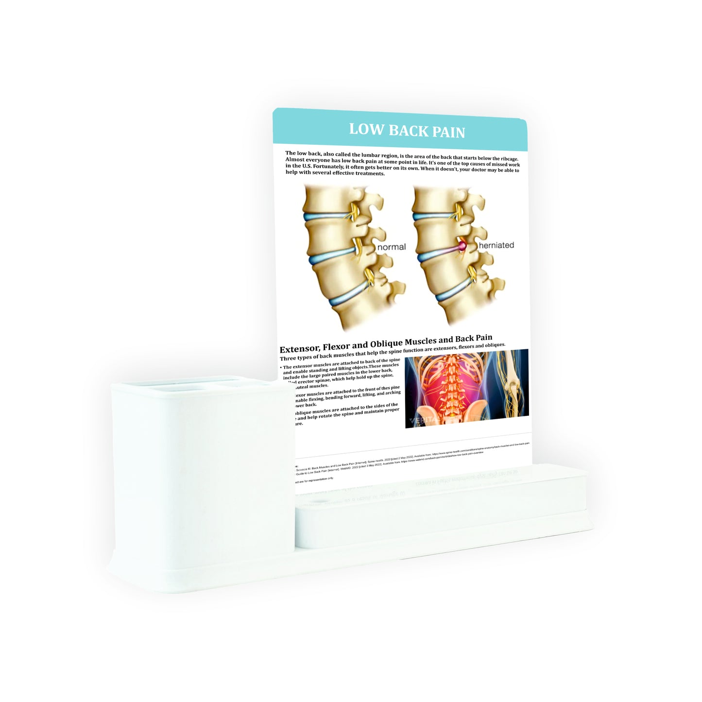 Low Back Pain: 1 Slides Write & Wipe with Stationary Stand