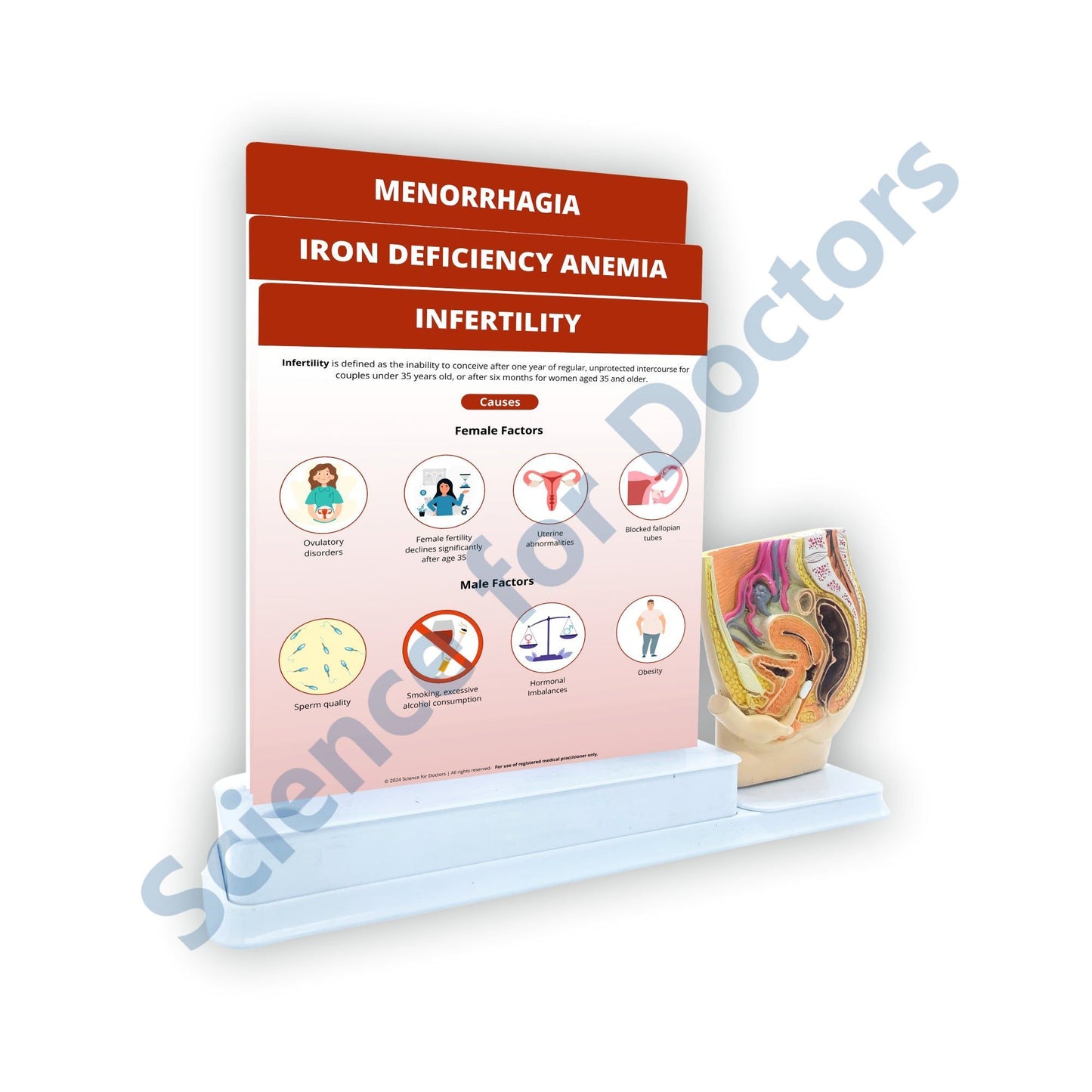 Infertility: 3 Slides Write & Wipe With Model On Stand