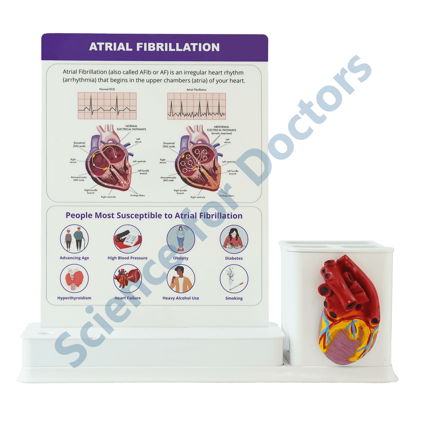 Atrial Fibrillation : 1 Slide Write and wipe with anatomical model on stationery stand