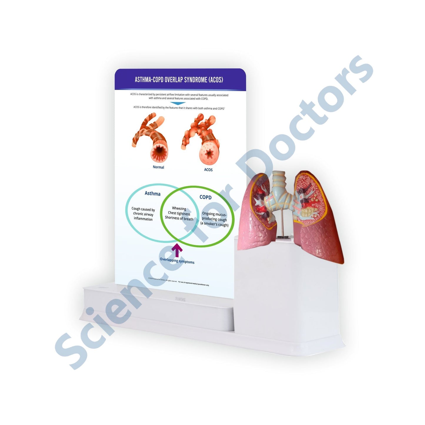 Asthma-COPD Overlap Syndrome (ACOS): 1 Slide write and wipe with anatomical model on stand