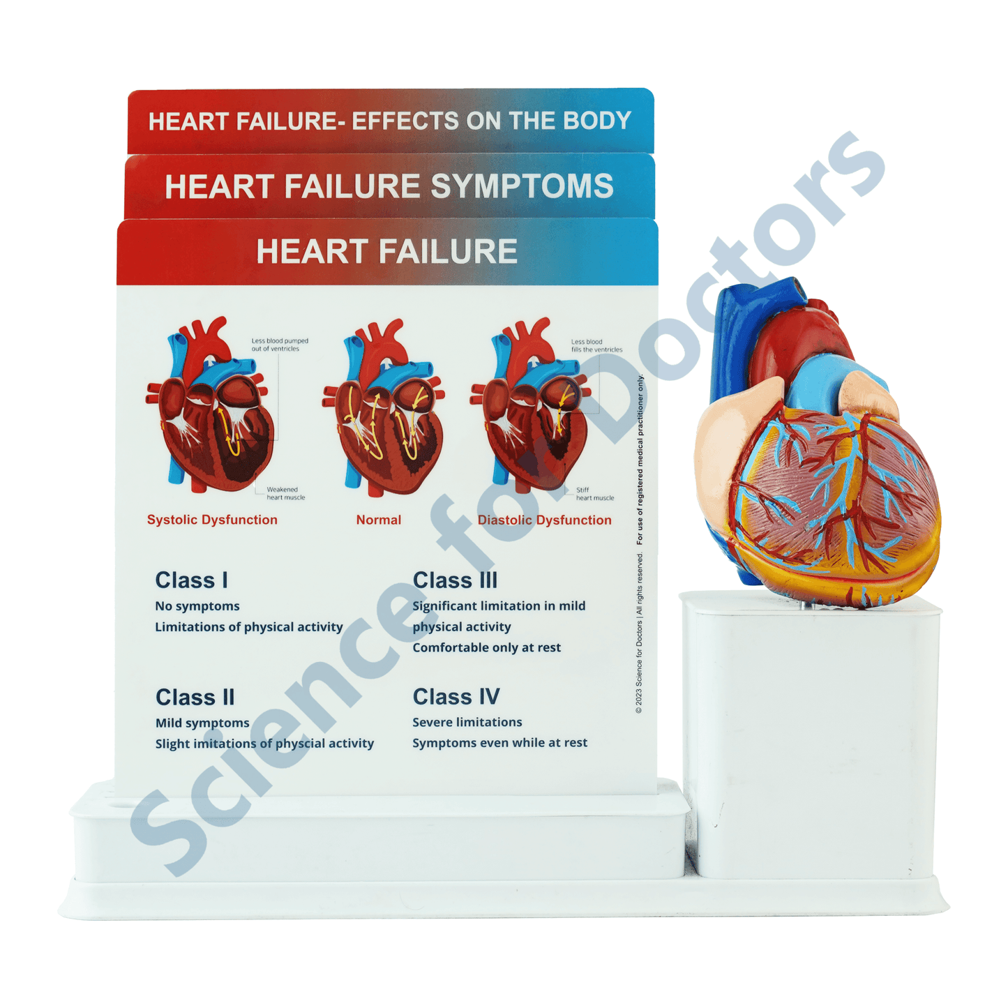 Heart Failure: 3 Slide Write and Wipe with Anatomical Model on Stand