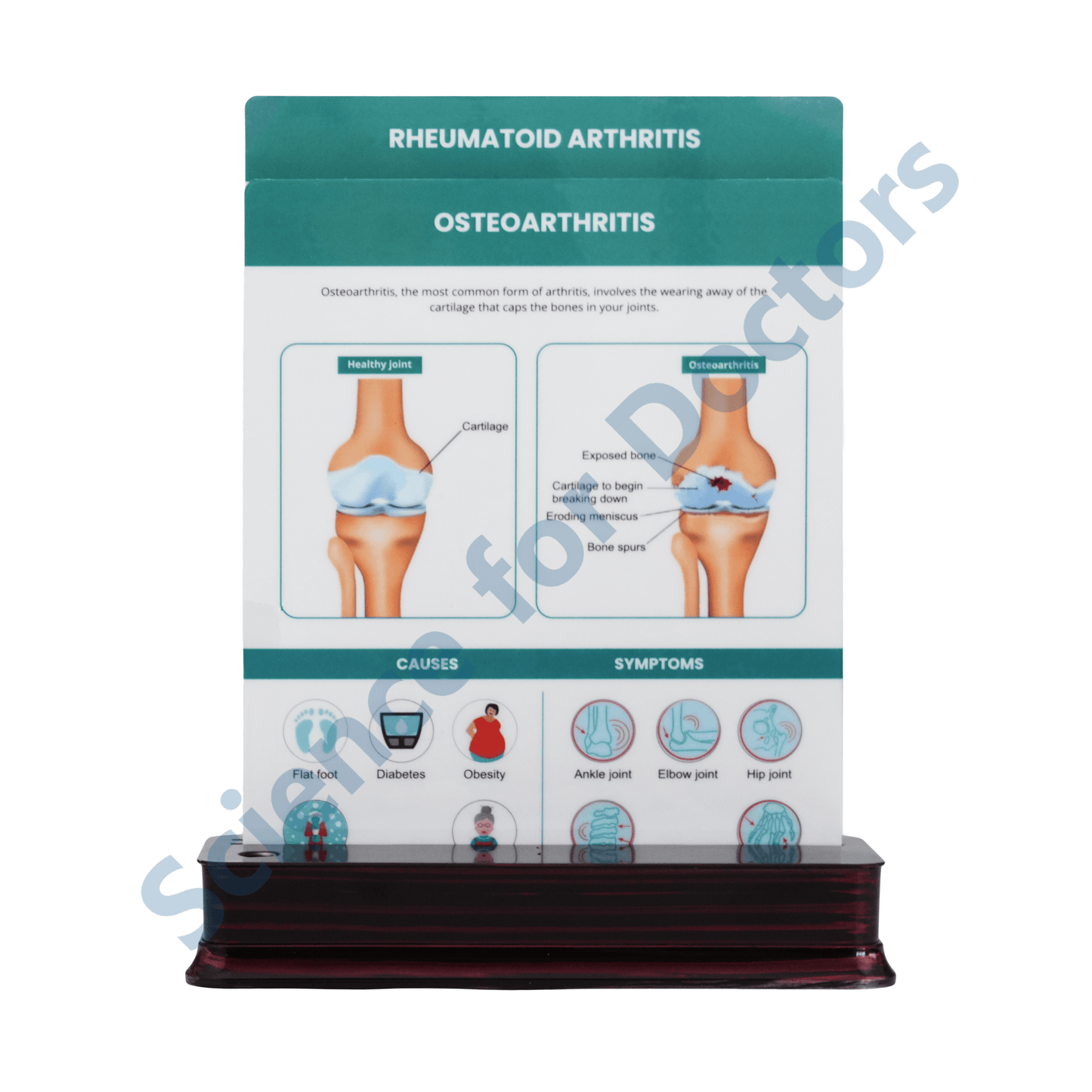 Osteoarthritis: 2 slide on stand