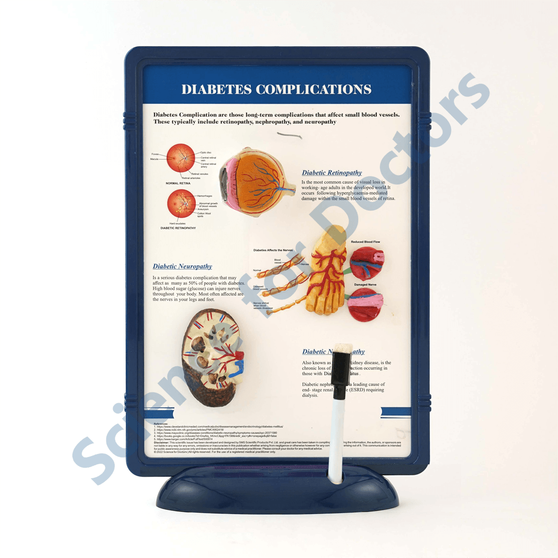 Diabetes Complications: 3D Therapy Frame