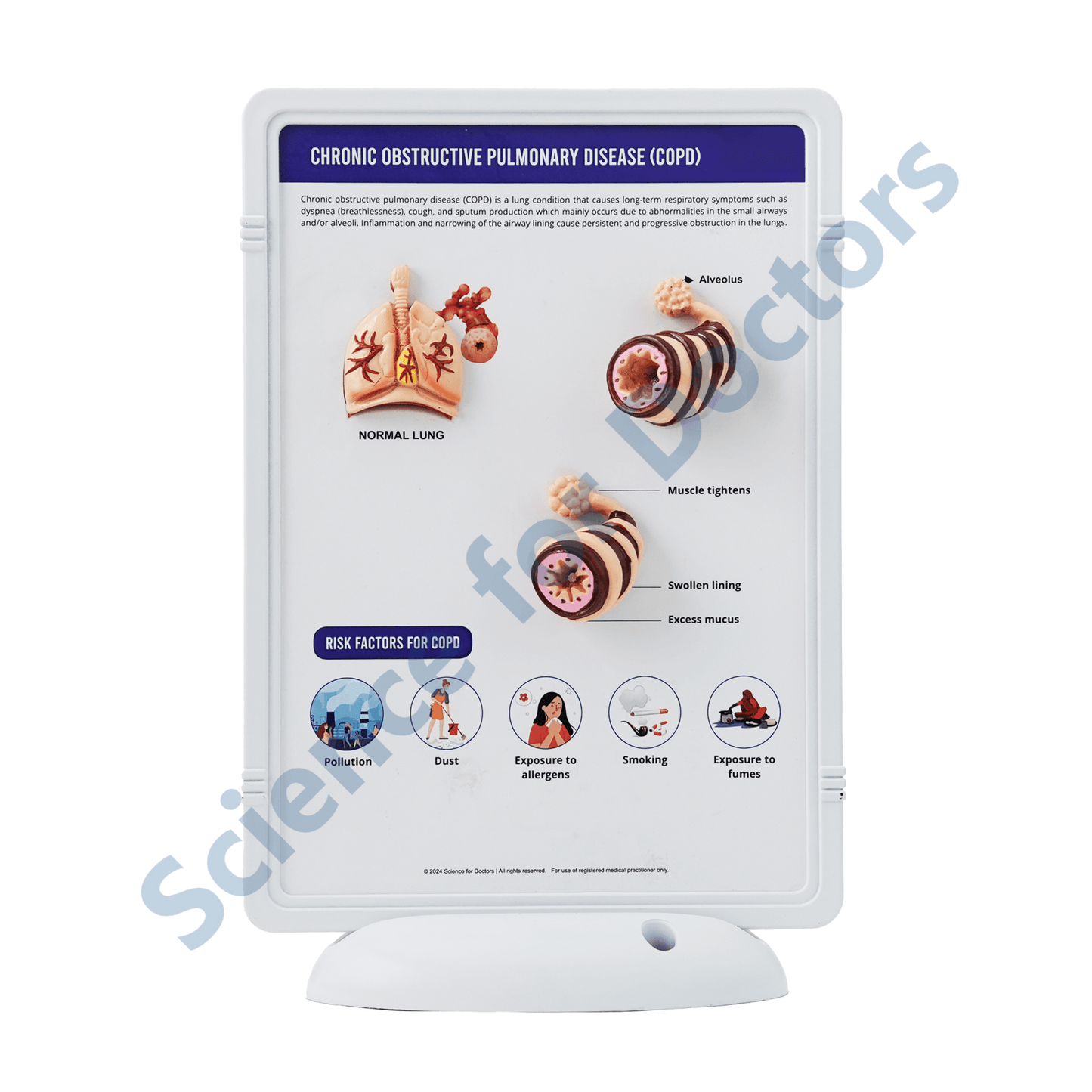 COPD(Chronic Obstructive Pulmonary Disease): 3D Therapy Frame