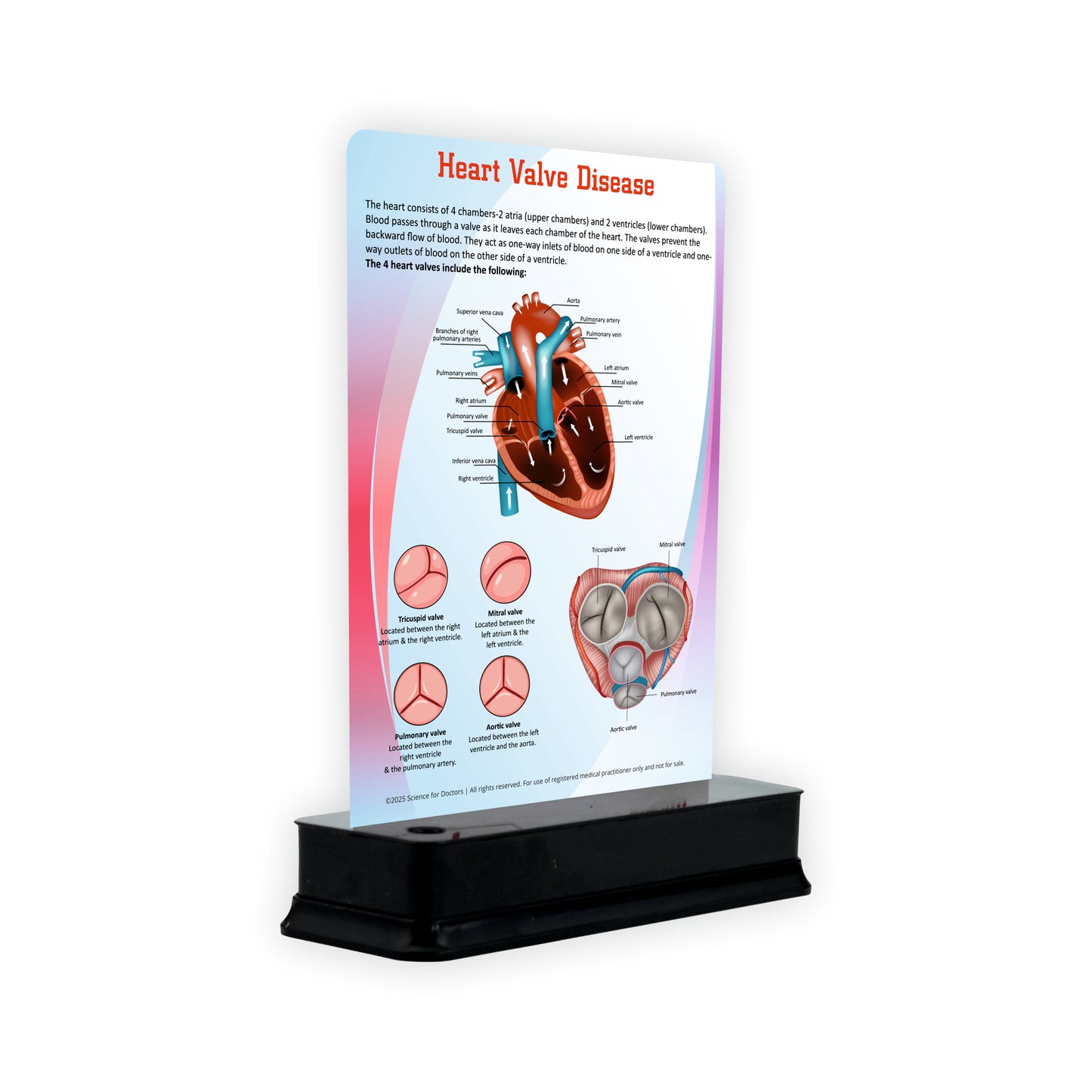 Heart Valve Disease: 1 Slide With Stand